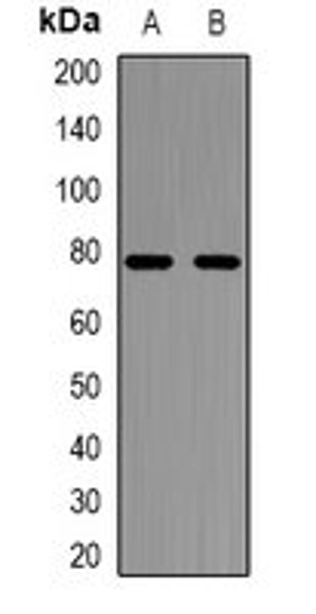 Western blot analysis of Jurkat (Lane1), HL60 (Lane2) whole cell lysates using NFATC1 antibody