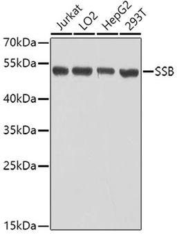 Western blot - SSB antibody (A0630)