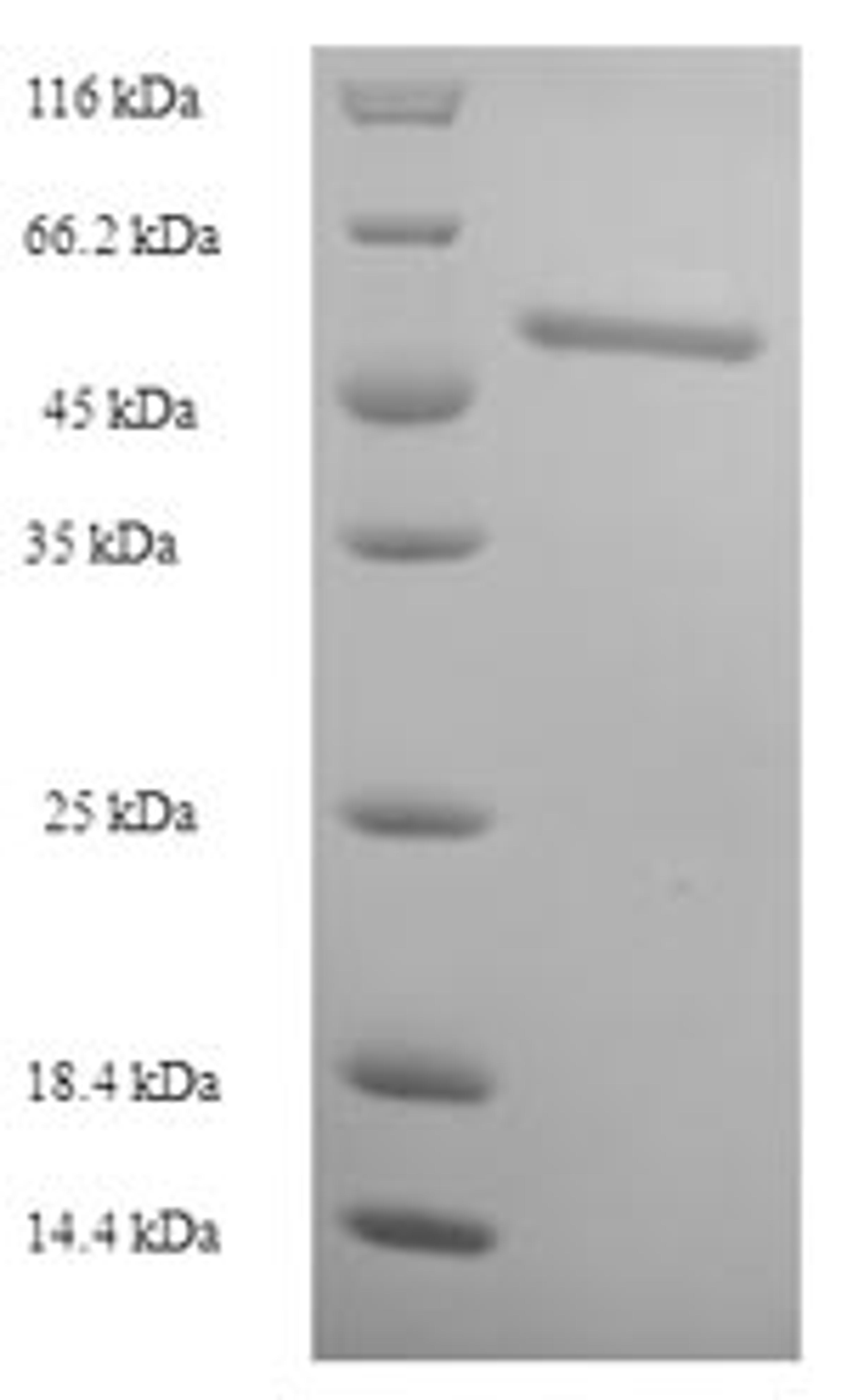 (Tris-Glycine gel) Discontinuous SDS-PAGE (reduced) with 5% enrichment gel and 15% separation gel.