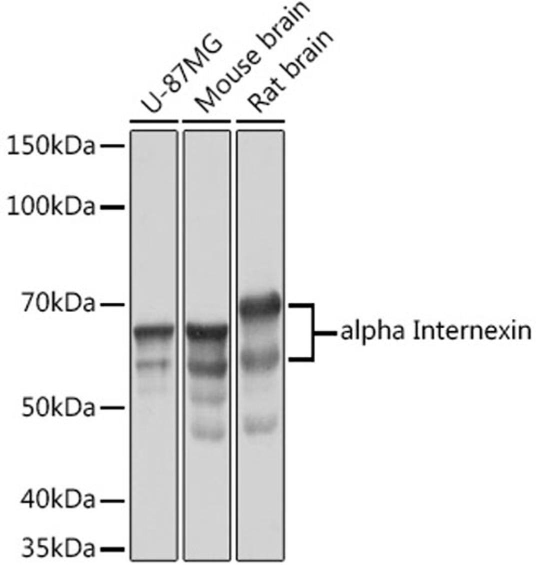 Western blot - alpha Internexin Rabbit mAb (A3596)