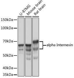 Western blot - alpha Internexin Rabbit mAb (A3596)