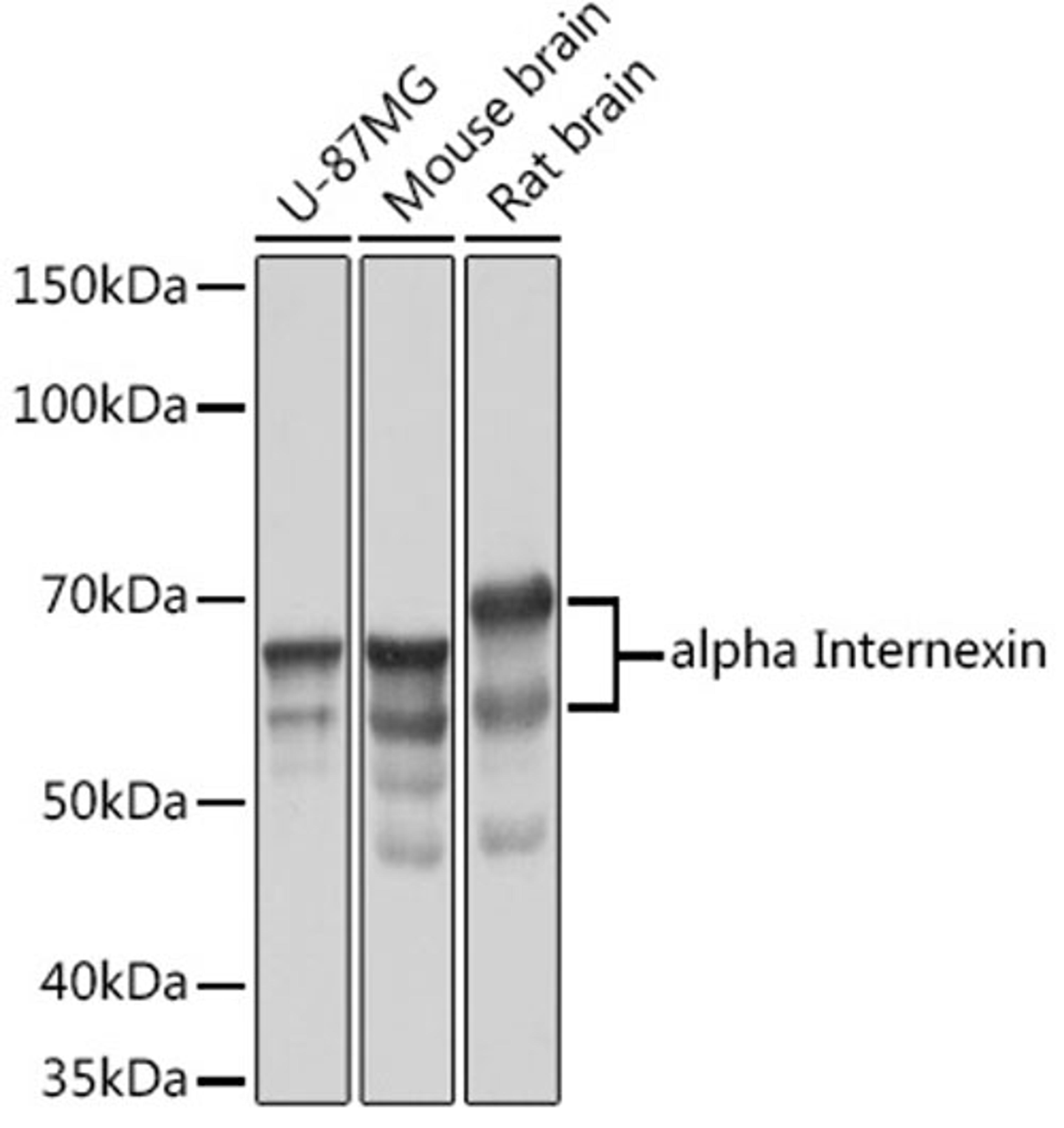 Western blot - alpha Internexin Rabbit mAb (A3596)