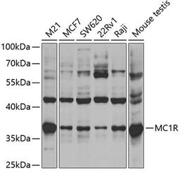 Western blot - MC1R antibody (A3009)