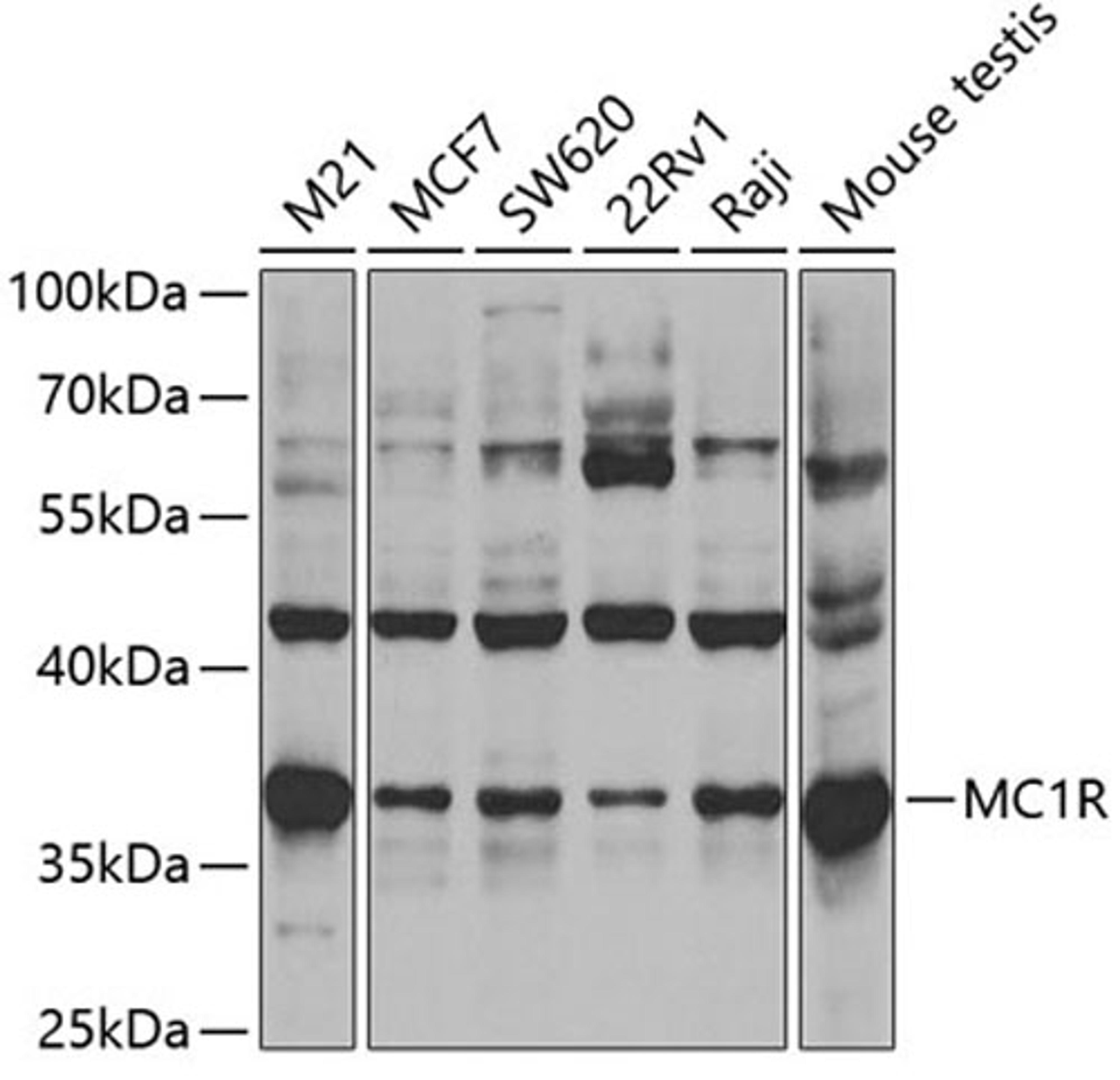Western blot - MC1R antibody (A3009)