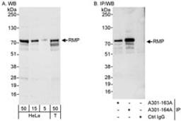 Detection of human RMP by western blot and immunoprecipitation.