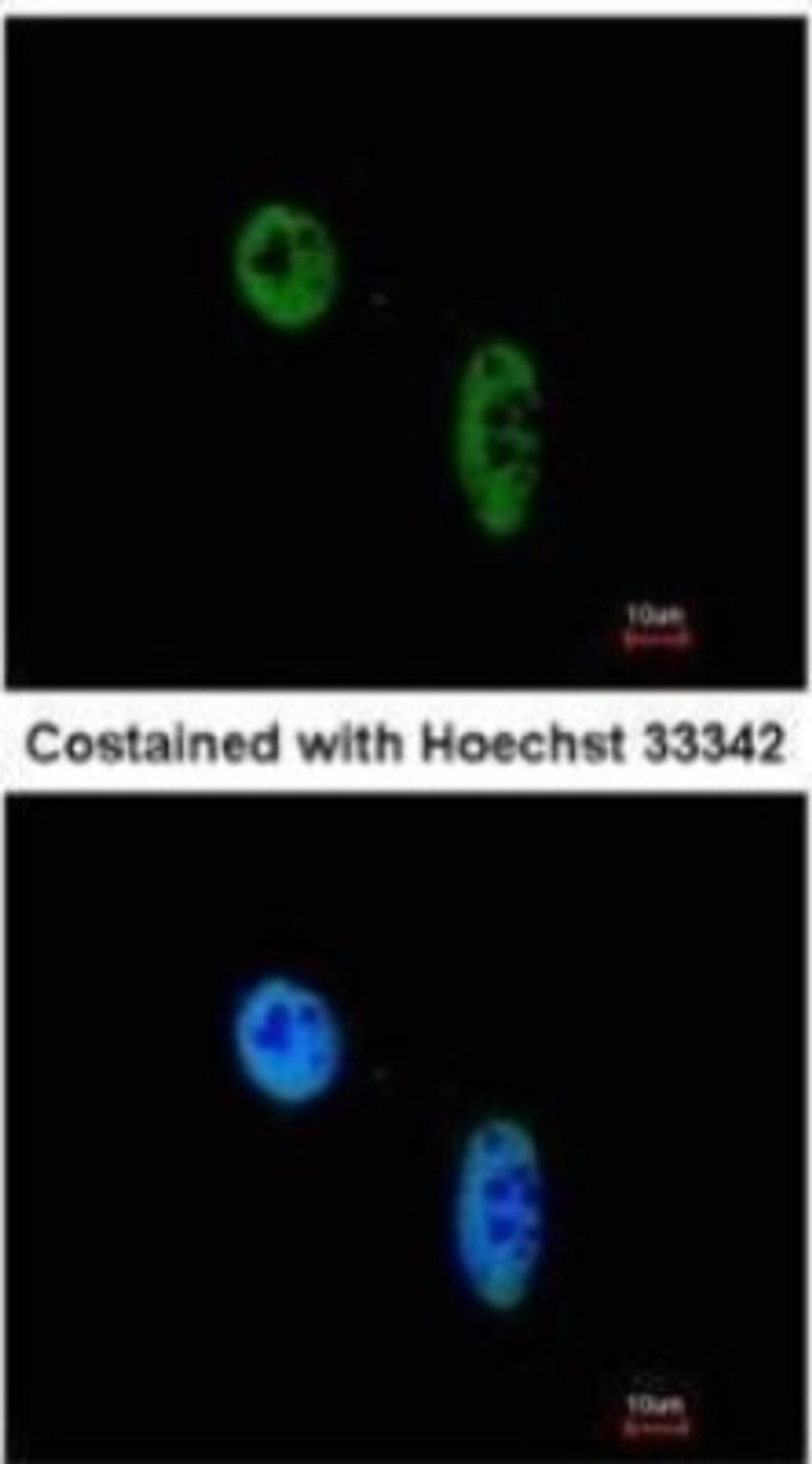 Immunocytochemistry/Immunofluorescence: RAG2 Antibody [NBP2-43666] - Analysis of paraformaldehyde-fixed HeLa, using RAG2 antibody at 1:200 dilution.