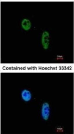 Immunocytochemistry/Immunofluorescence: RAG2 Antibody [NBP2-43666] - Analysis of paraformaldehyde-fixed HeLa, using RAG2 antibody at 1:200 dilution.