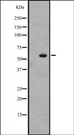 Western blot analysis of HEK293 cells using TOPRS antibody