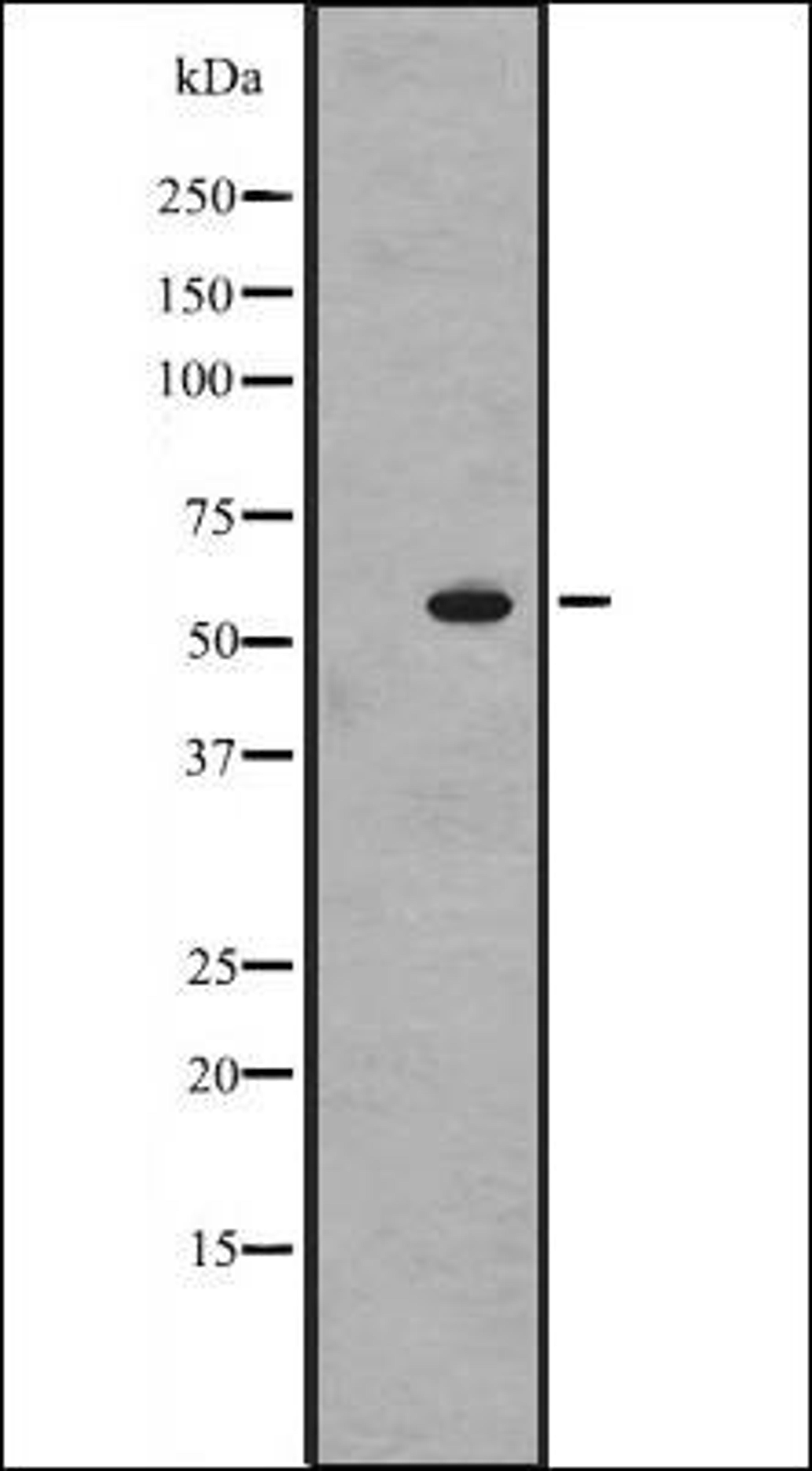 Western blot analysis of HEK293 cells using TOPRS antibody