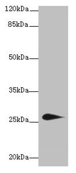 Western blot. All lanes: TMEM174 antibody at 0.8µg/ml + Mouse kidney tissue. Secondary. Goat polyclonal to rabbit IgG at 1/10000 dilution. Predicted band size: 27, 24 kDa. Observed band size: 27 kDa