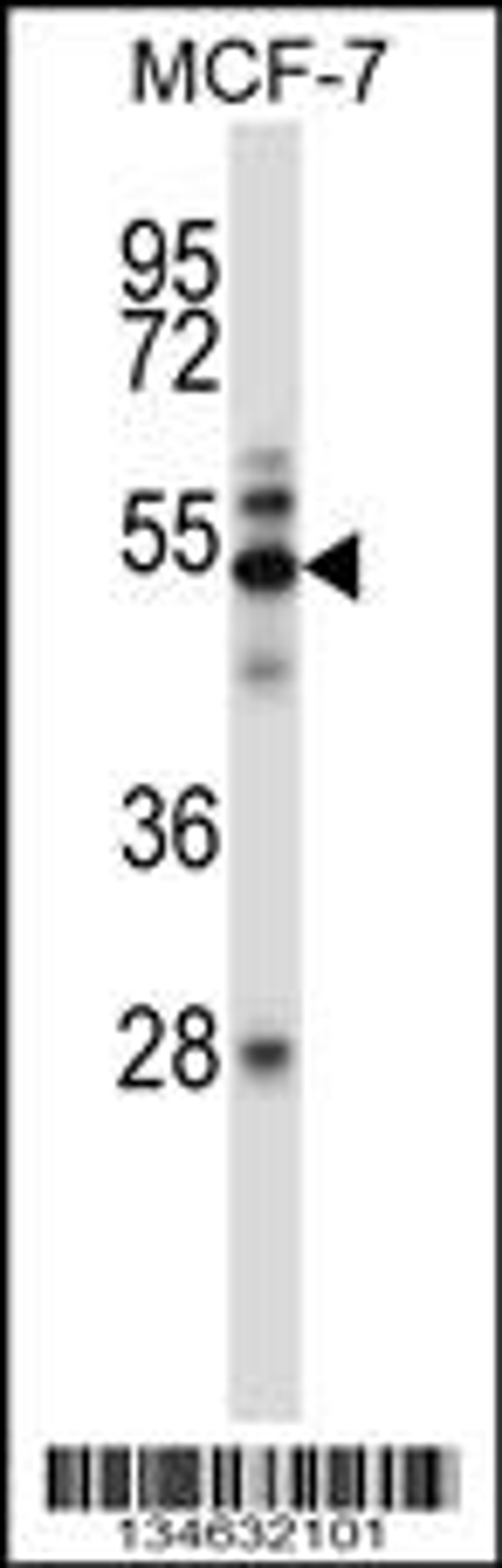 Western blot analysis in MCF-7 cell line lysates (35ug/lane).