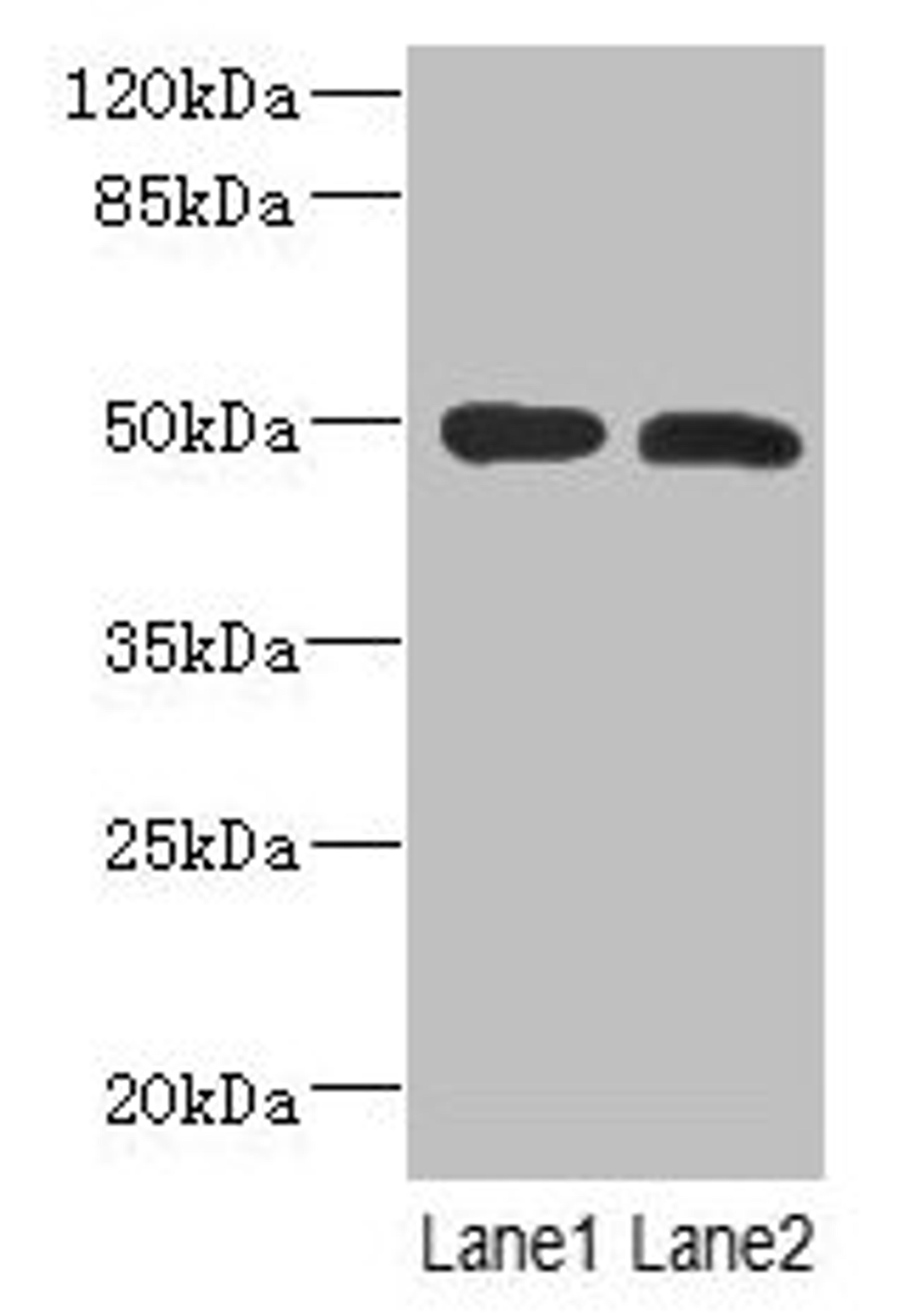 Western Blot. All lanes: RGMA antibody at 12µg/ml. Lane 1: Mouse brain tissue. Lane 2: Hela whole cell lysate. Secondary. Goat polyclonal to rabbit IgG at 1/10000 dilution. Predicted band size: 50, 48, 51 kDa. Observed band size: 50 kDa