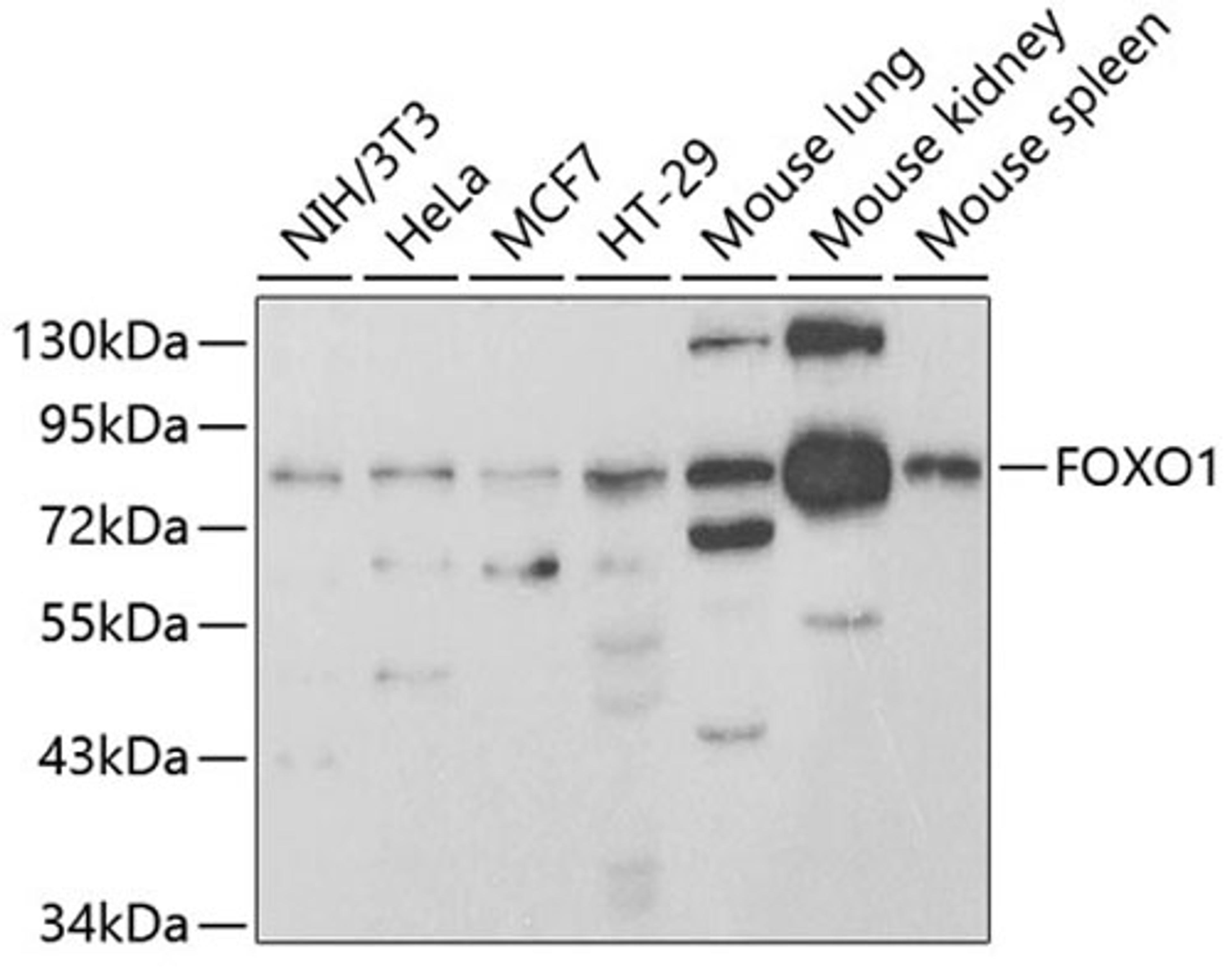 Western blot - FOXO1 antibody (A2934)