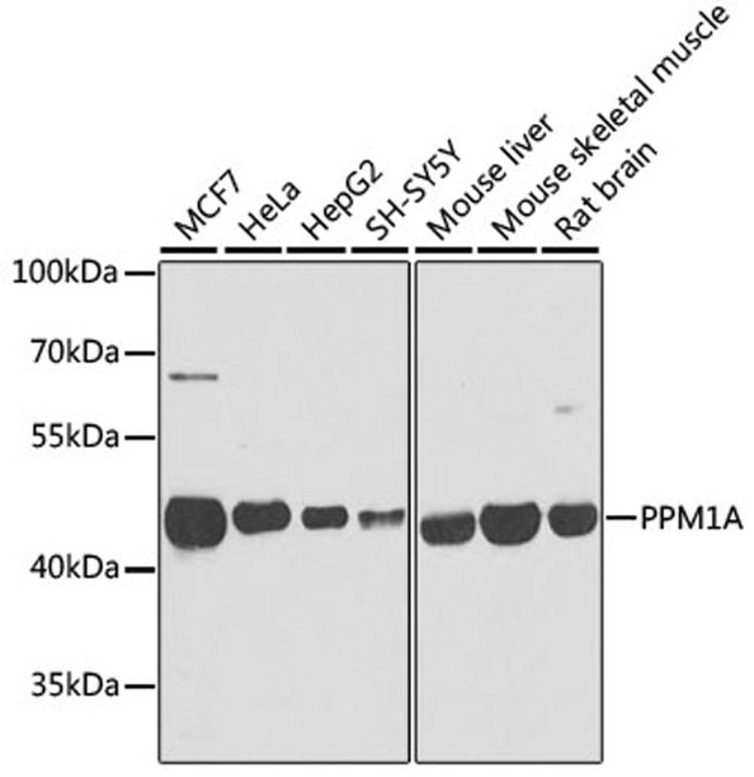 Western blot - PPM1A antibody (A6699)