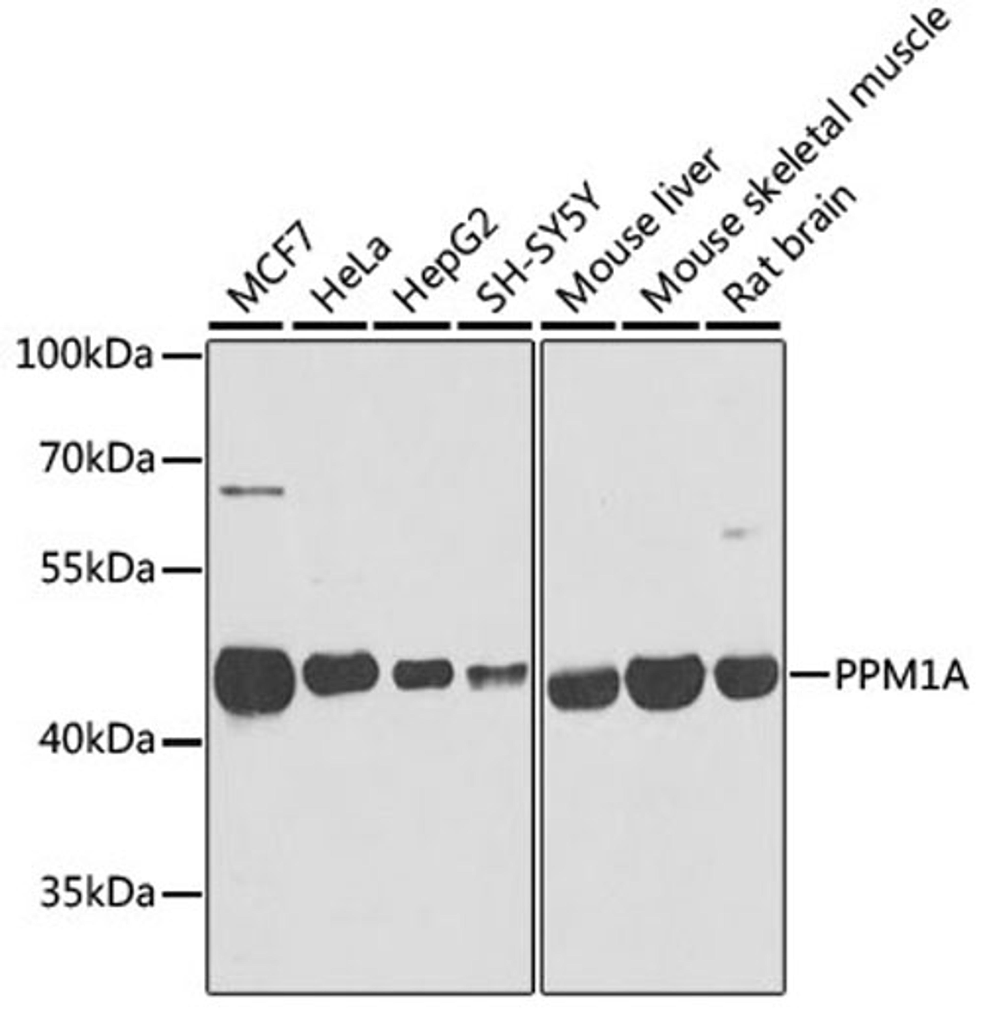 Western blot - PPM1A antibody (A6699)