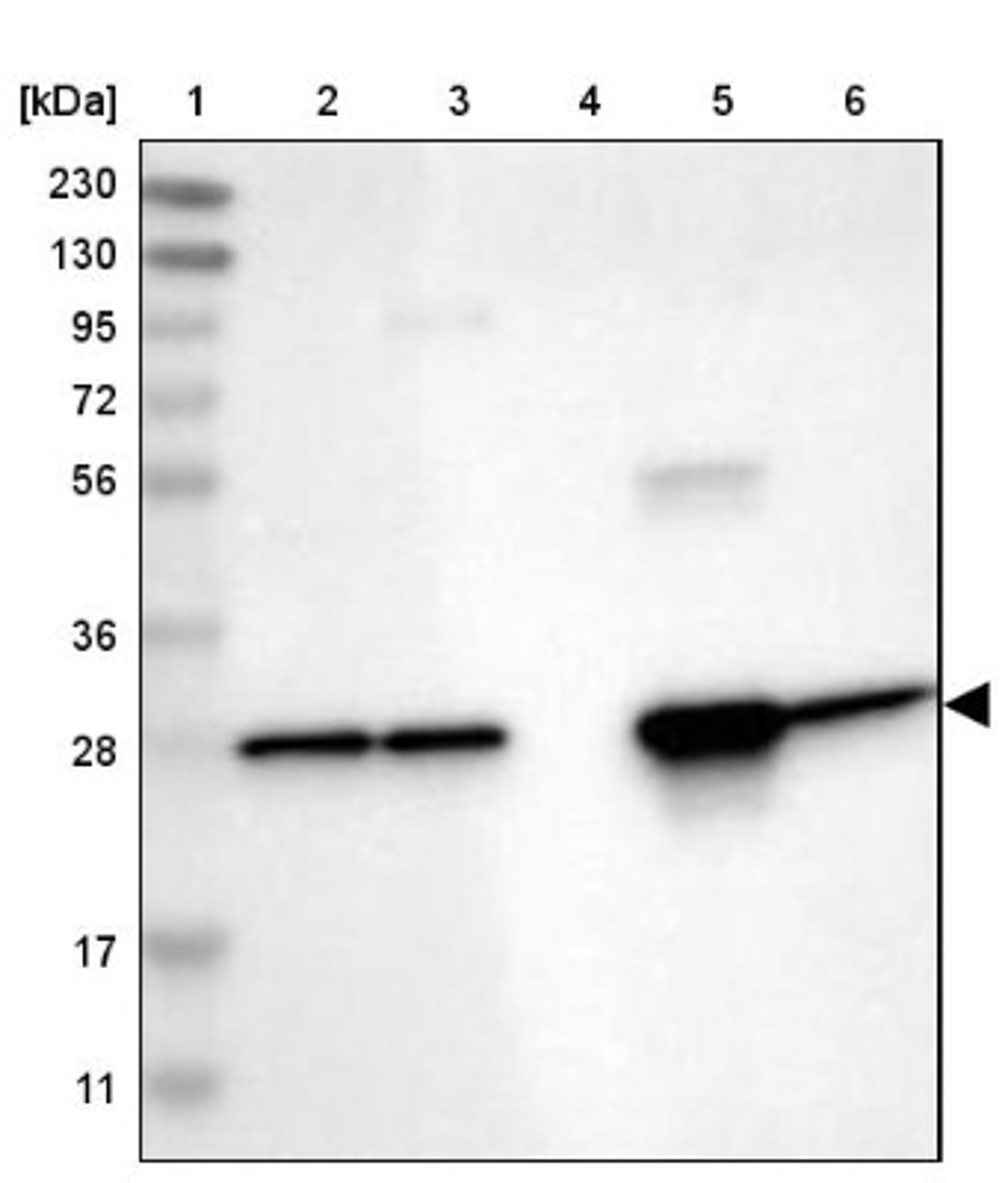 Western Blot: UCHL3 Antibody [NBP1-86037] - Lane 1: Marker [kDa] 230, 130, 95, 72, 56, 36, 28, 17, 11<br/>Lane 2: Human cell line RT-4<br/>Lane 3: Human cell line U-251MG sp<br/>Lane 4: Human plasma (IgG/HSA depleted)<br/>Lane 5: Human liver tissue<br/>Lane 6: Human tonsil tissue