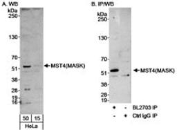 Detection of human MST4(MASK) by western blot and immunoprecipitation.