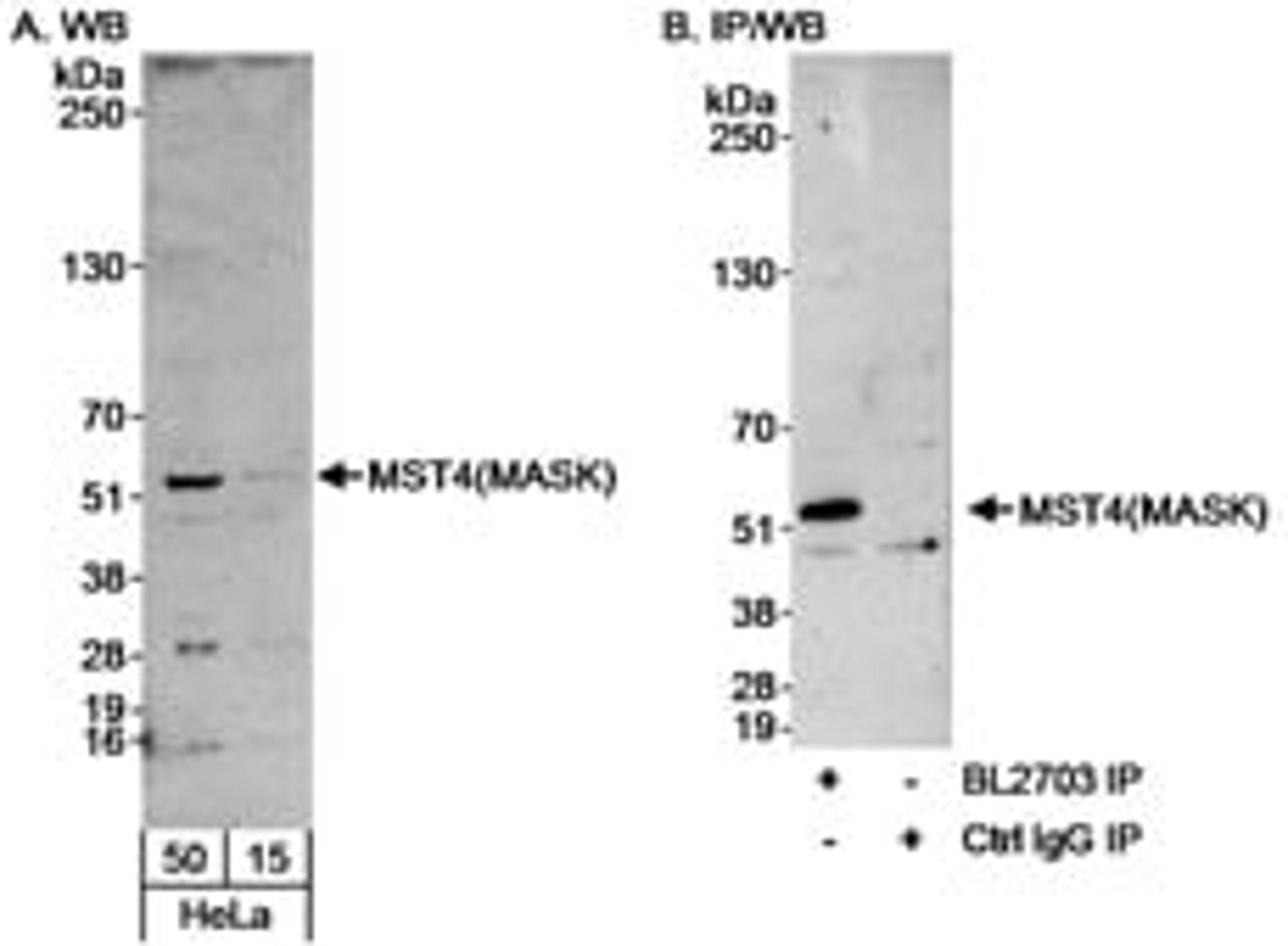 Detection of human MST4(MASK) by western blot and immunoprecipitation.