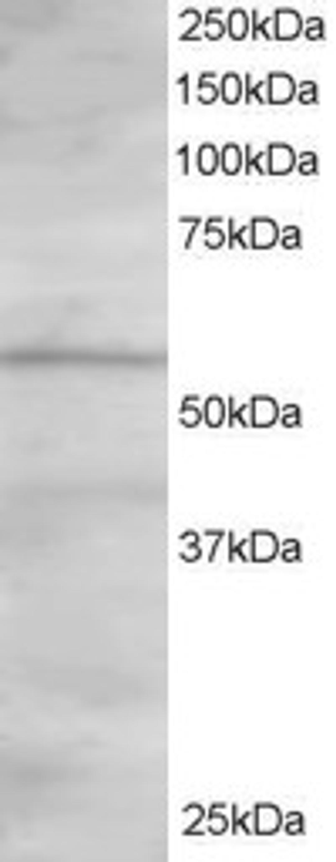 46-108 staining (1.5ug/ml) of Human Heart lysate (RIPA buffer, 30ug total protein per lane). Primary incubated for 1 hour. Detected by western blot using chemiluminescence.