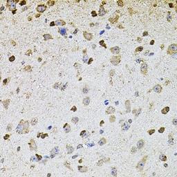 Immunohistochemistry of paraffin-embedded mouse brain using ALDH1A1 antibody