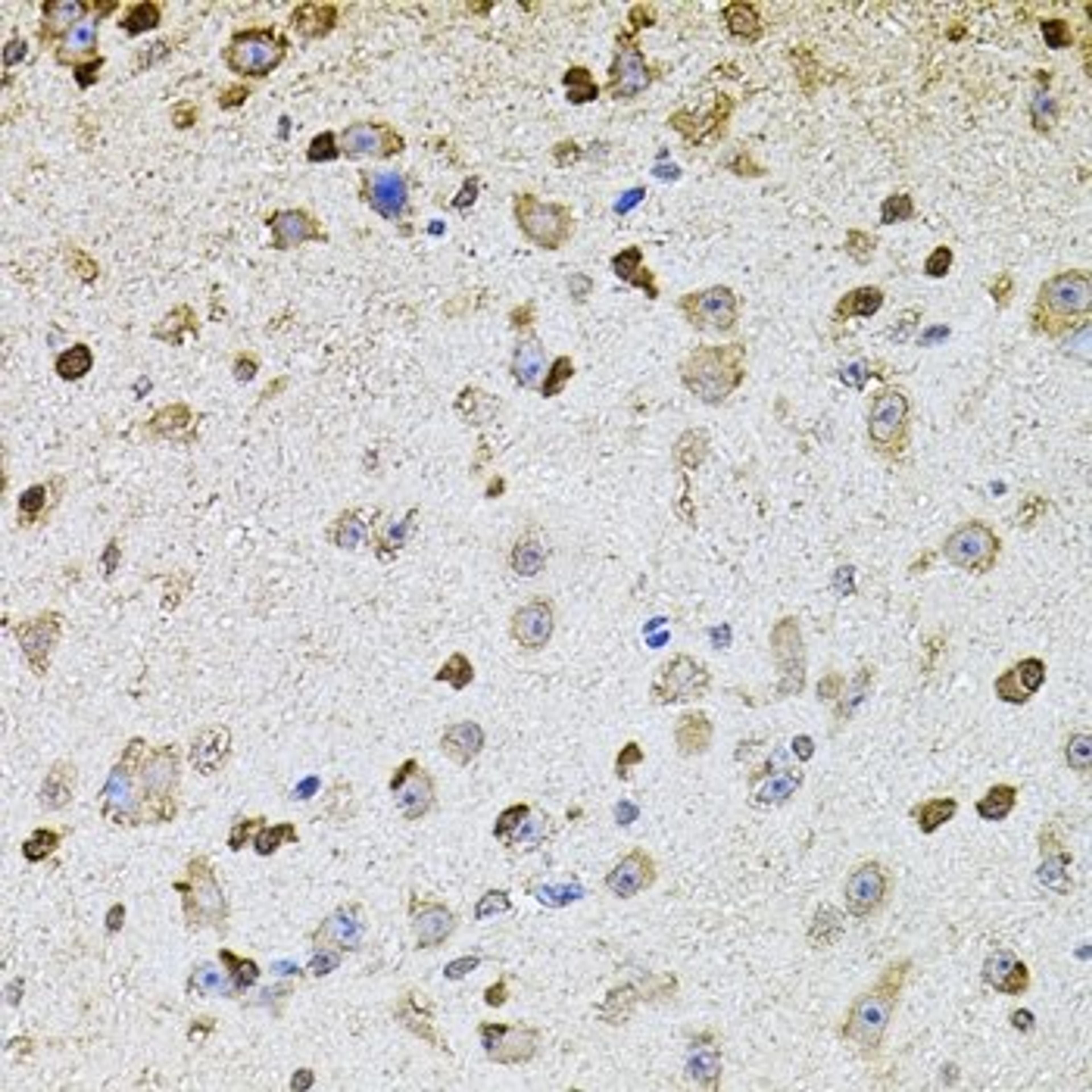 Immunohistochemistry of paraffin-embedded mouse brain using ALDH1A1 antibody