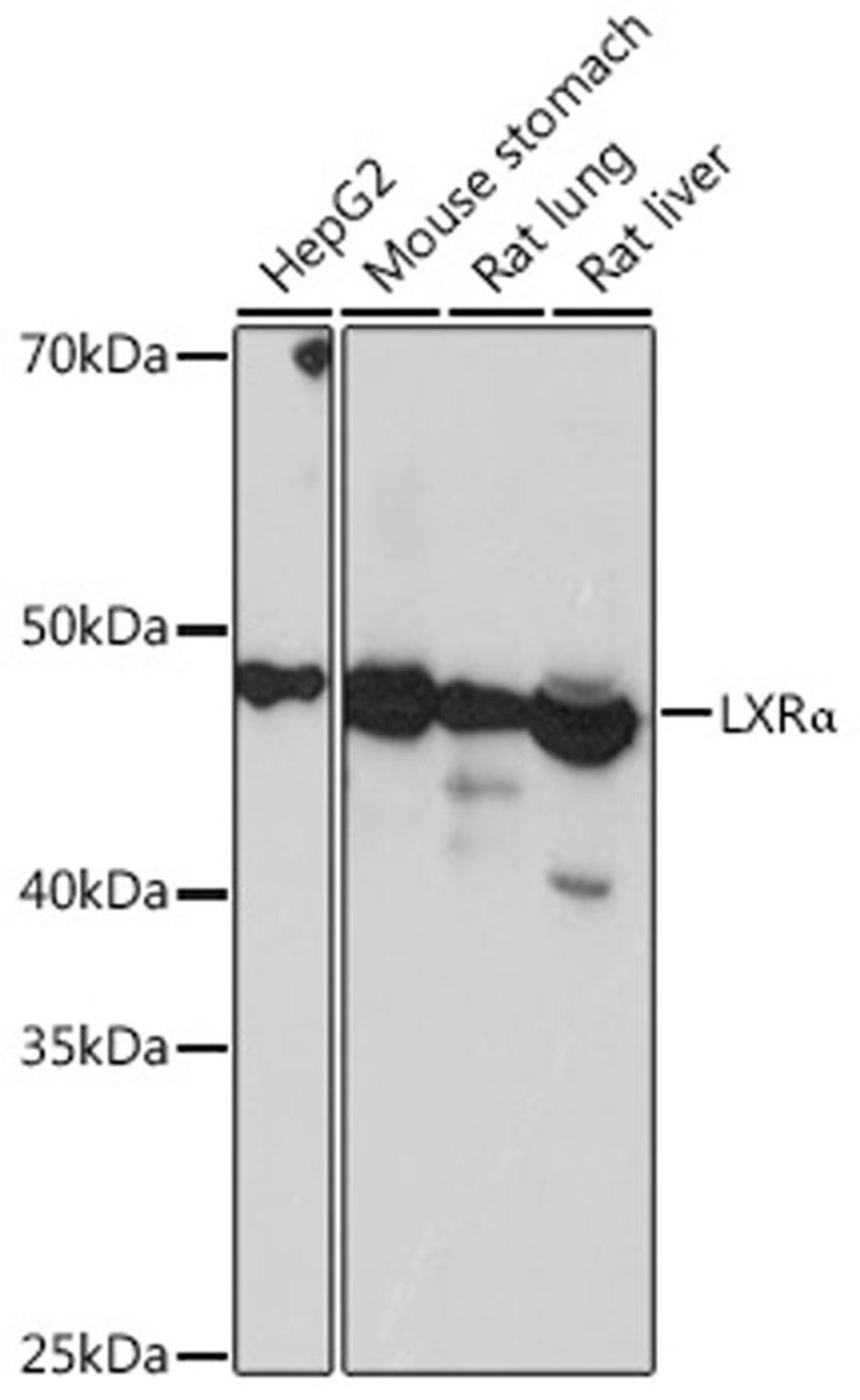 Western blot - LXRa Rabbit mAb (A3974)