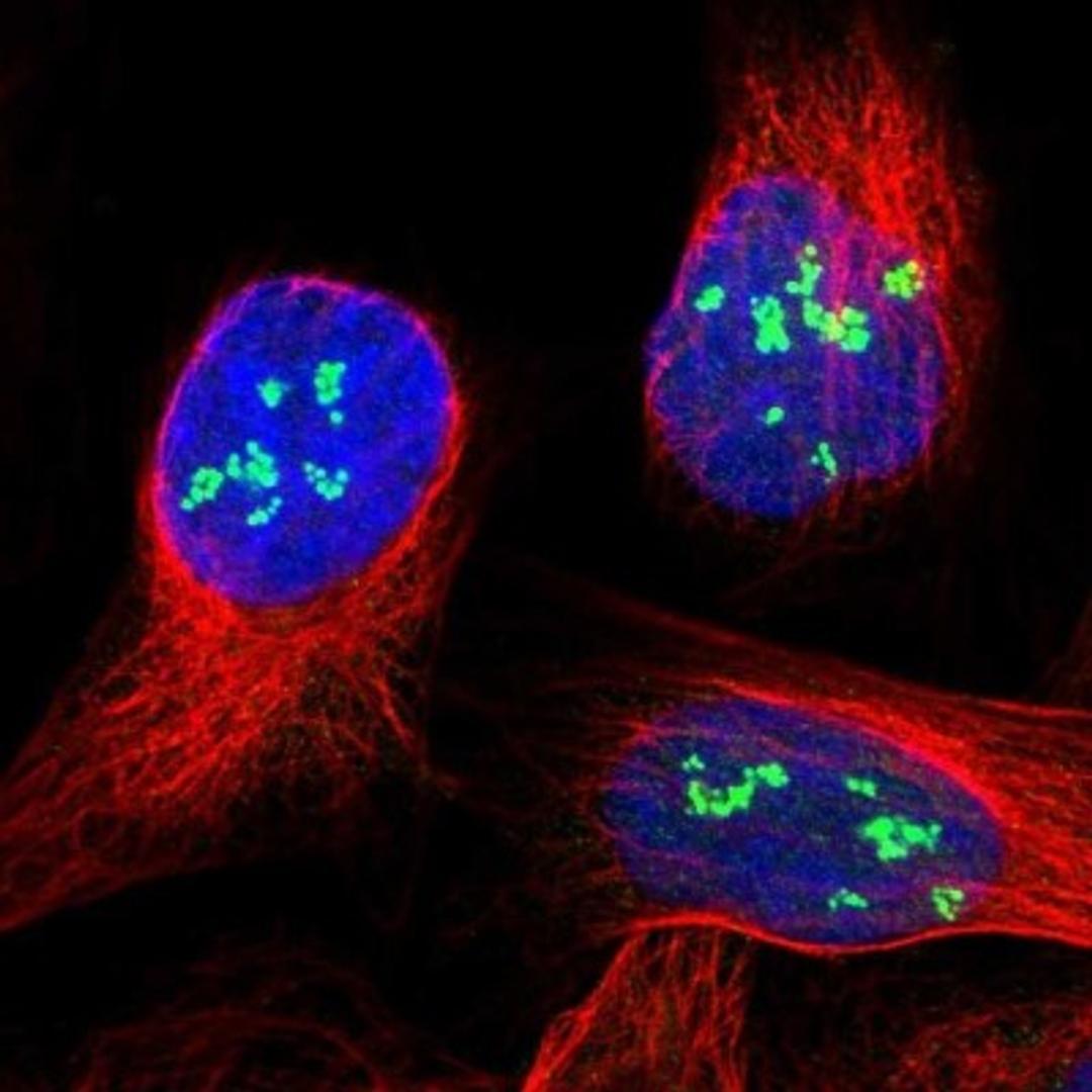 Immunocytochemistry/Immunofluorescence: KBTBD5 Antibody [NBP1-80723] - staining of human cell line U-2 OS shows positivity in nucleoli.