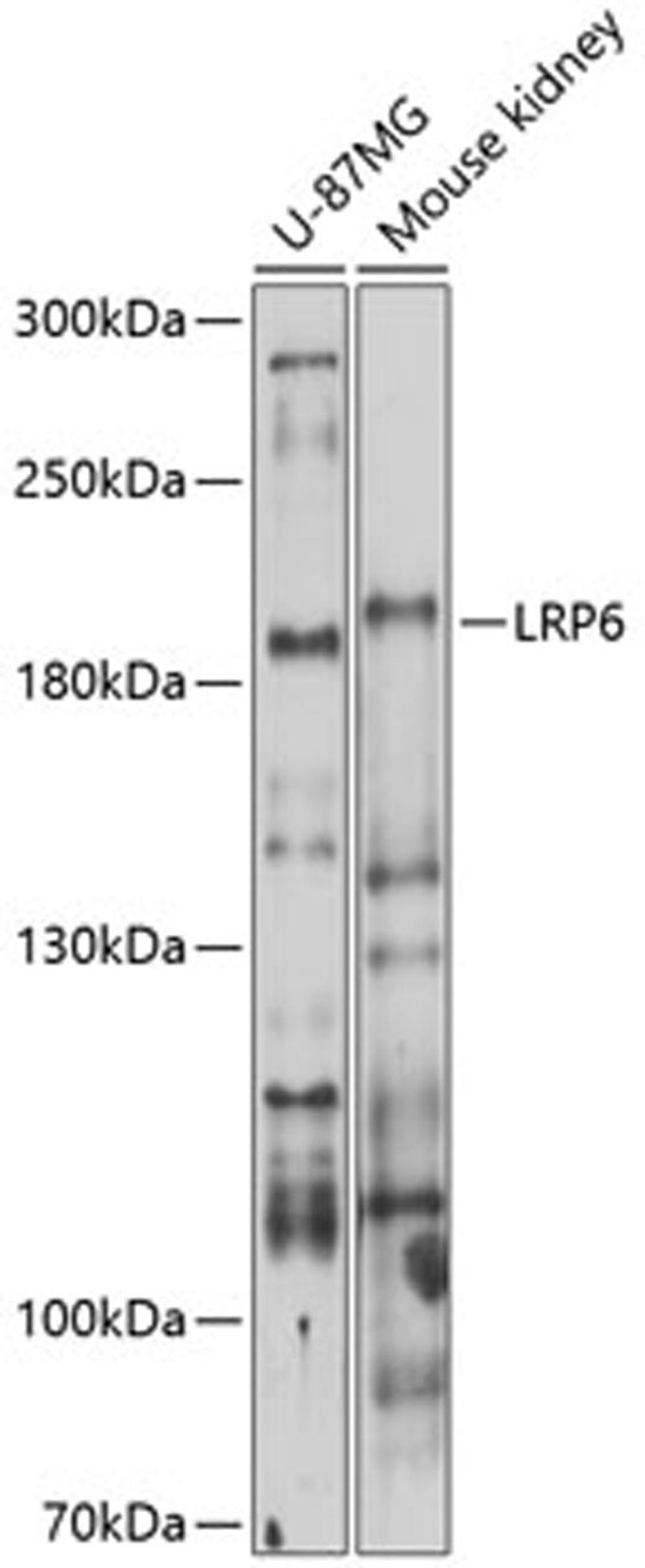 Western blot - LRP6 antibody (A13678)