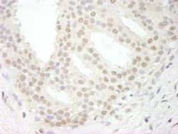 Detection of human USP34 by immunohistochemistry.