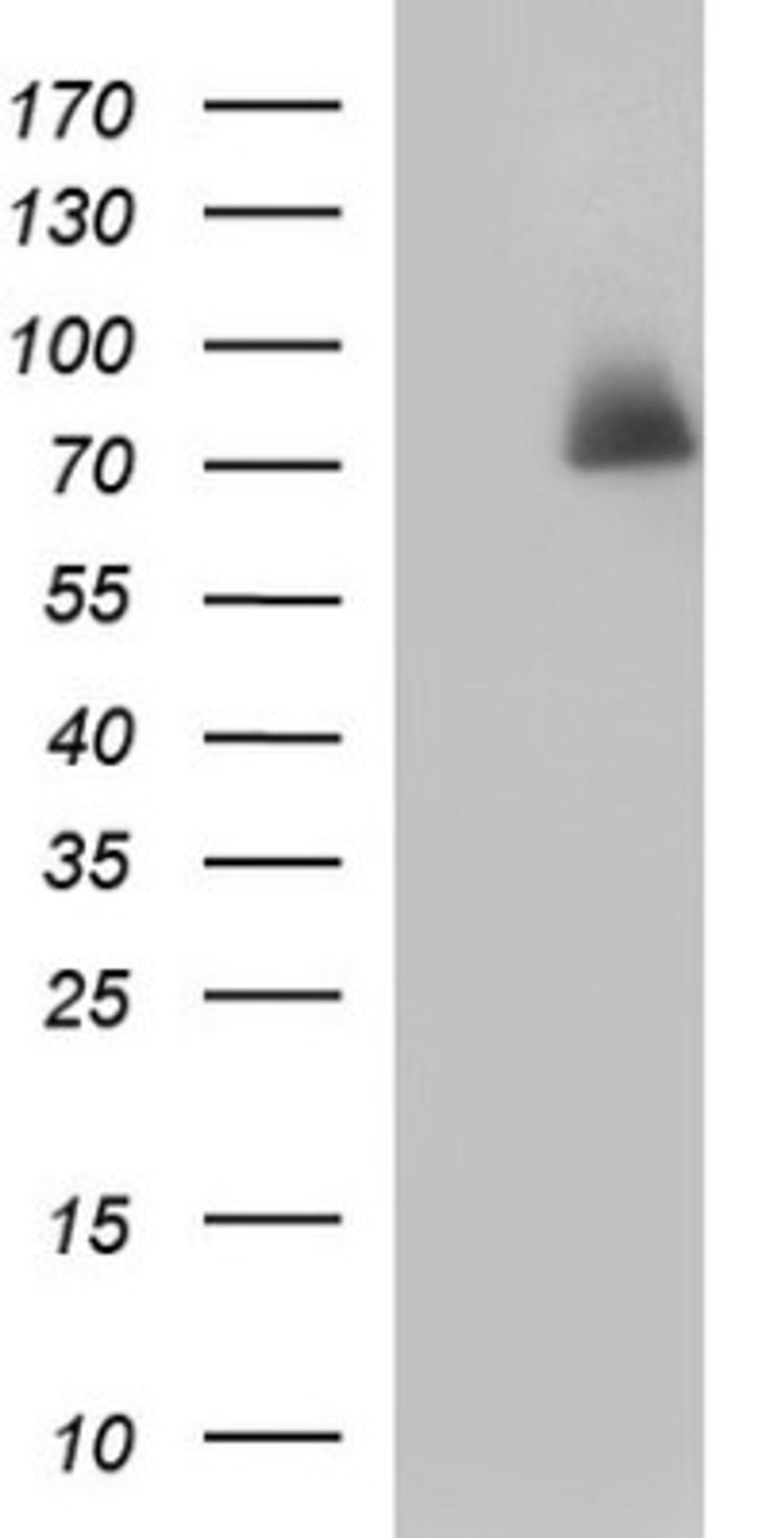 Western Blot: HSD17B4 Antibody (4C4) [NBP2-46005] - Analysis of HEK293T cells were transfected with the pCMV6-ENTRY control (Left lane) or pCMV6-ENTRY HSD17B4.