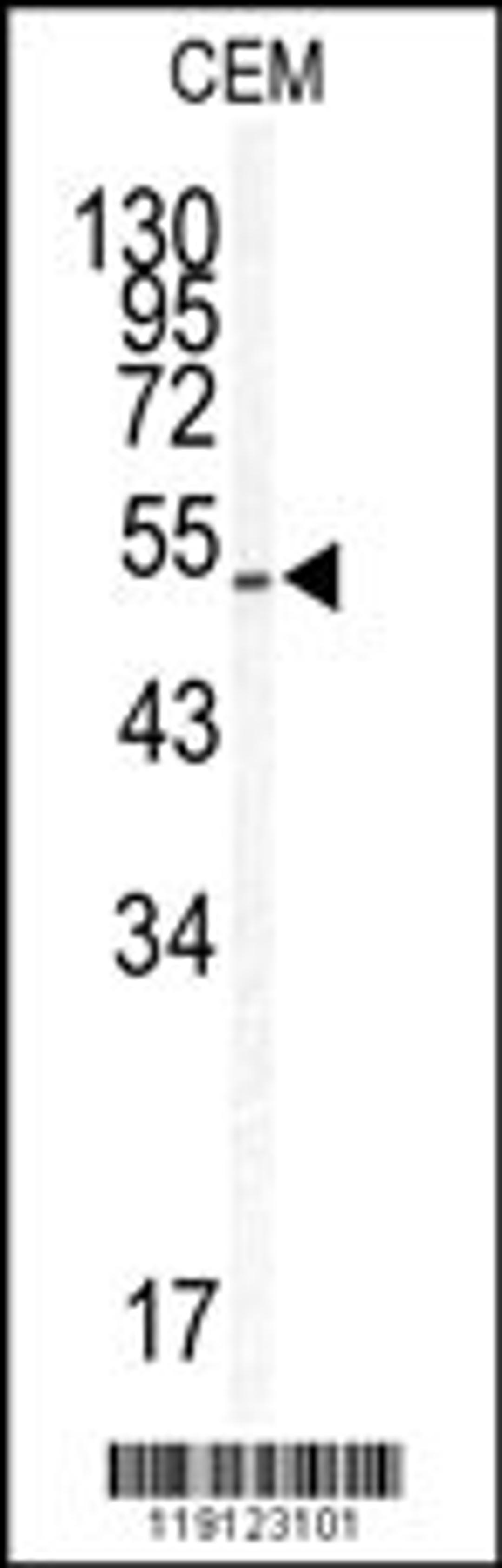 Western blot analysis of KLF5 antibody in CEM cell line lysates (35ug/lane)