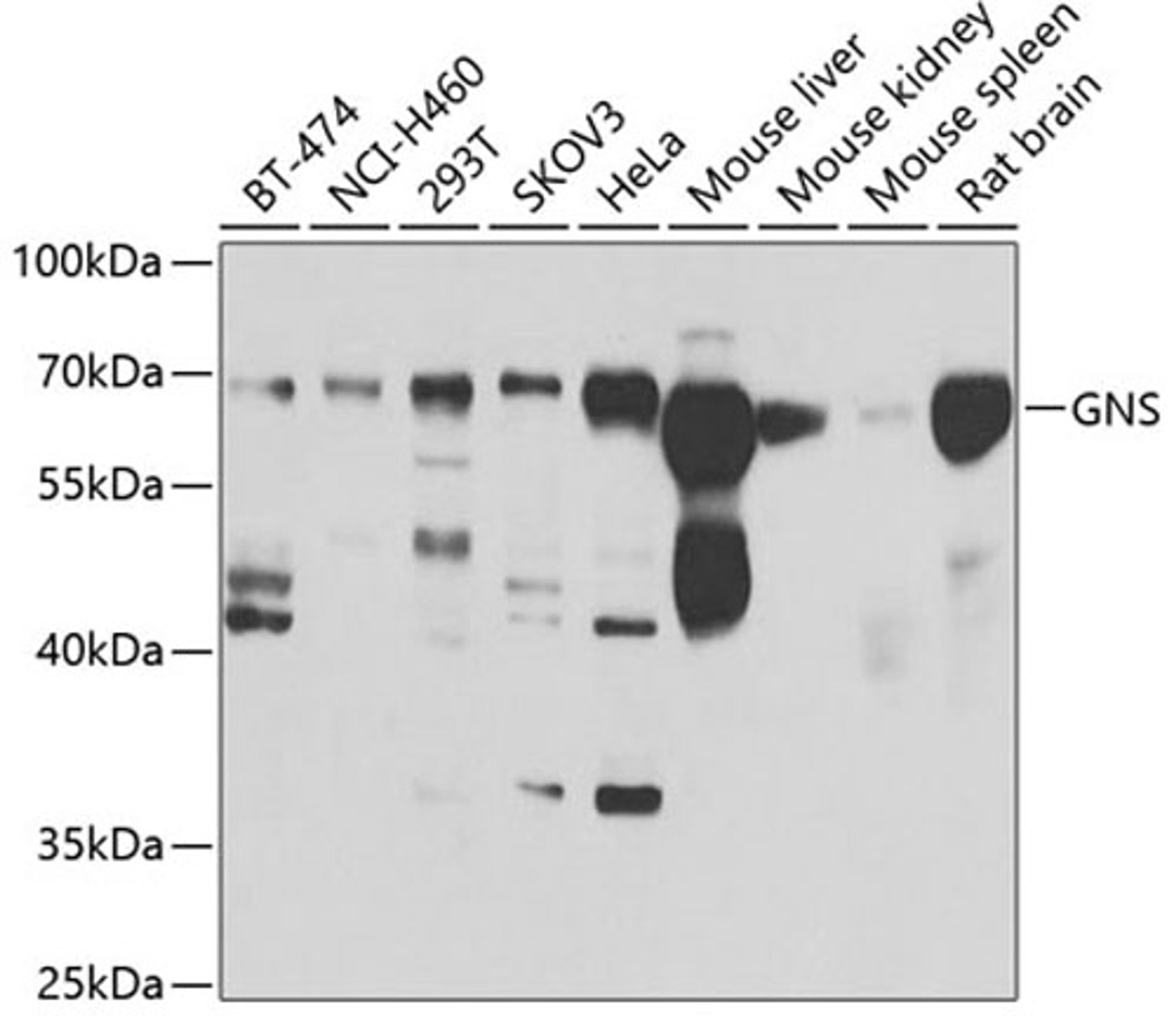 Western blot - GNS antibody (A7489)