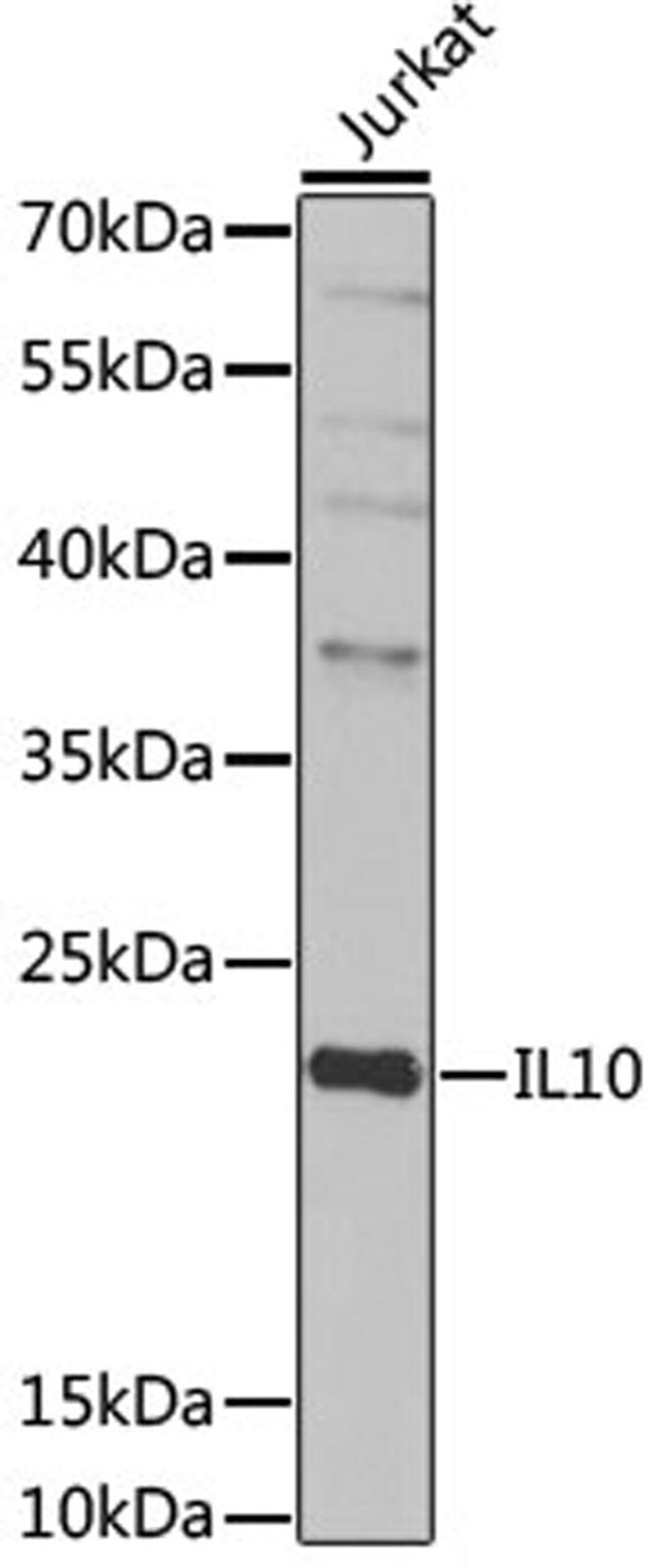 Western blot - IL10 antibody (A2171)