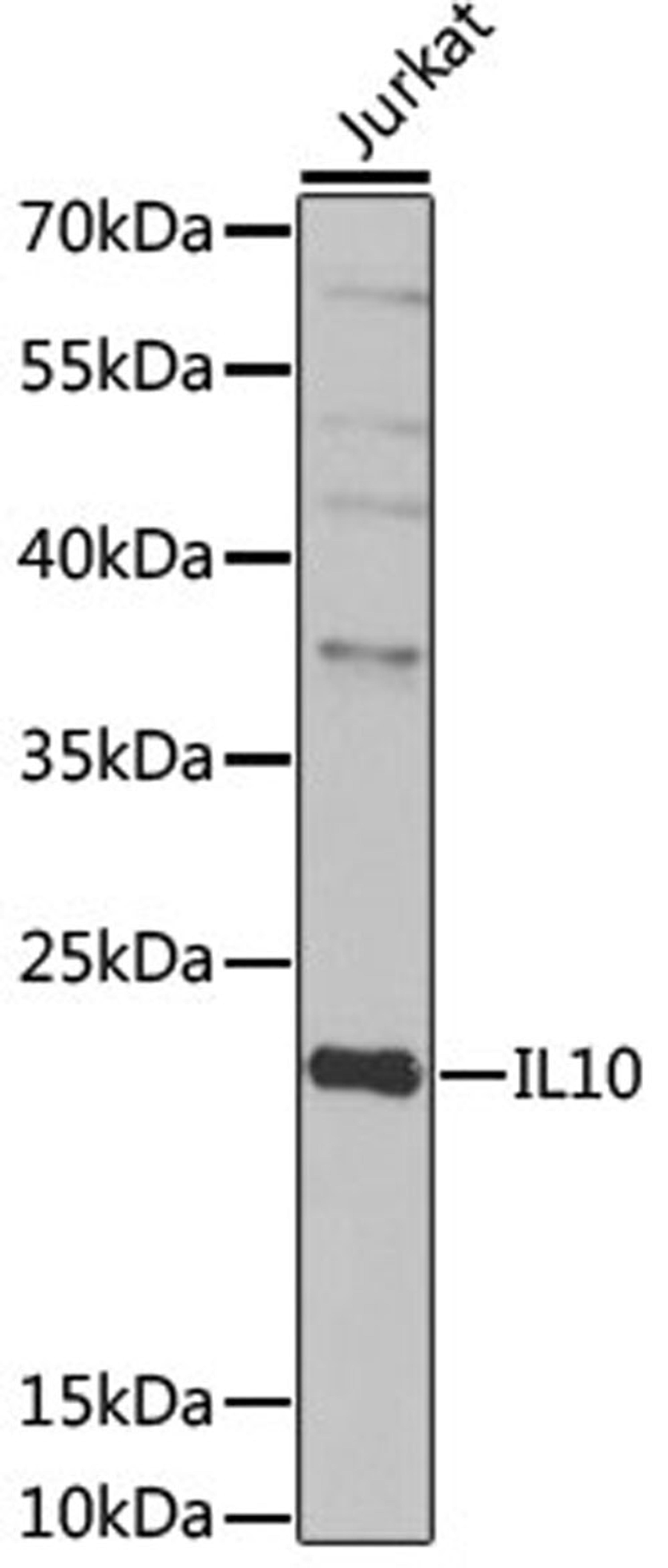 Western blot - IL10 antibody (A2171)