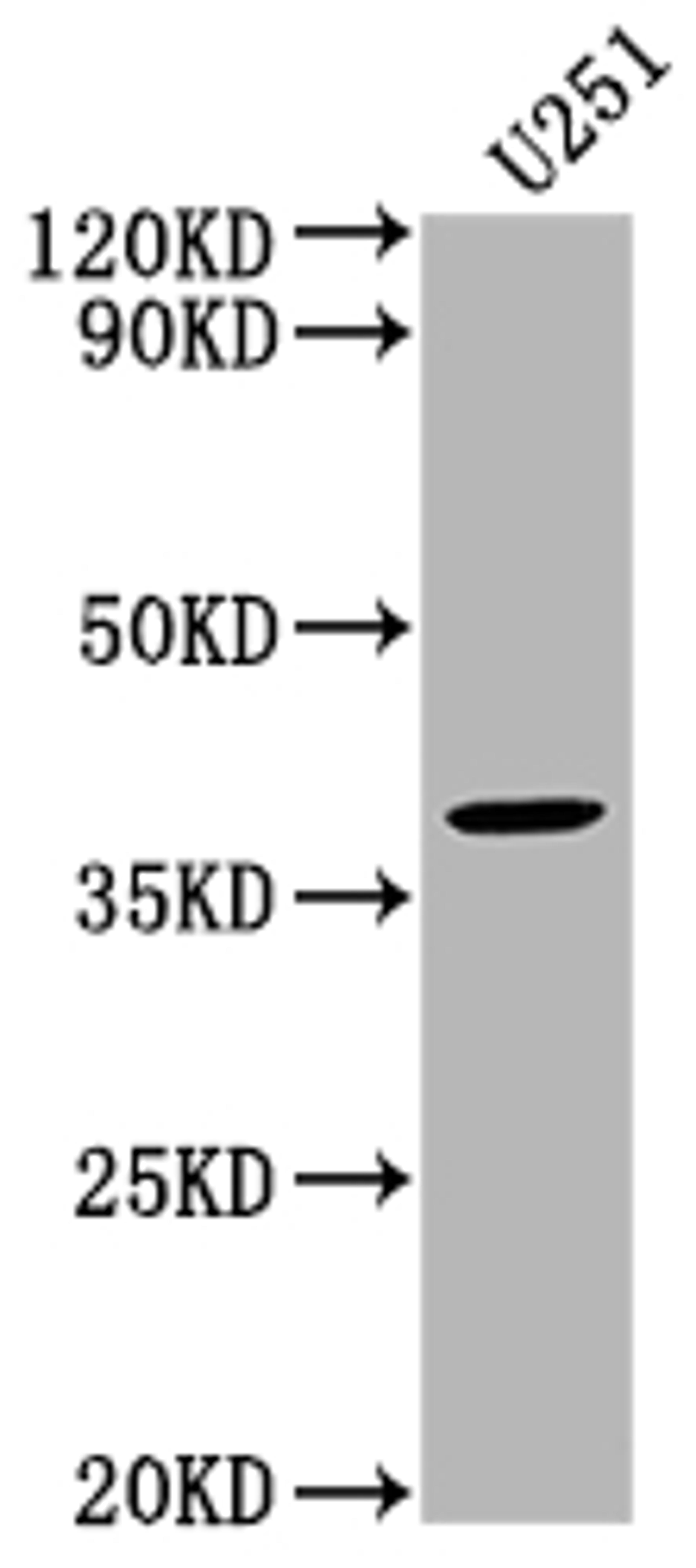 Western Blot. Positive WB detected in: U251 whole cell lysate. All lanes: FST antibody at 1:2000. Secondary. Goat polyclonal to rabbit IgG at 1/50000 dilution. Predicted band size: 39, 35 kDa. Observed band size: 39 kDa. 