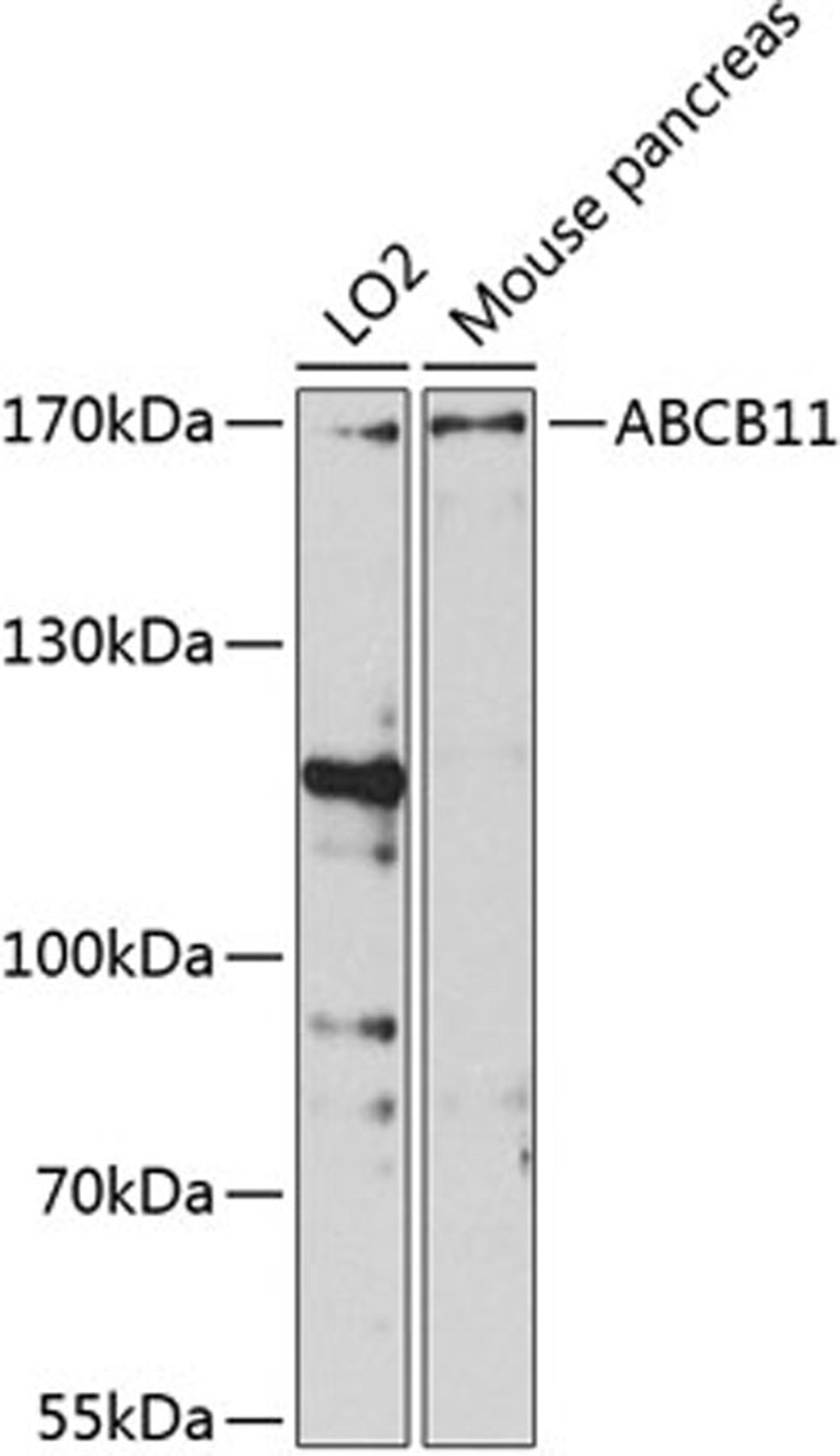 Western blot - ABCB11 antibody (A8467)