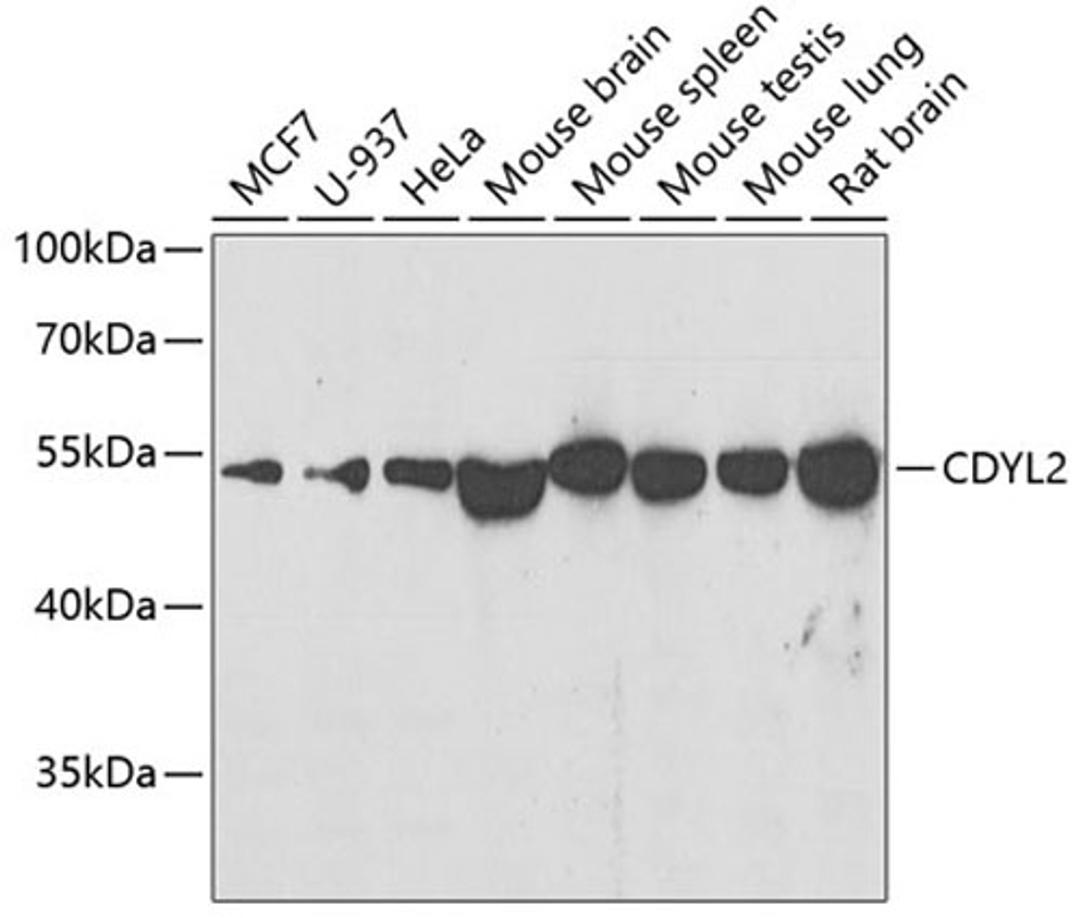 Western blot - CDYL2 antibody (A7401)