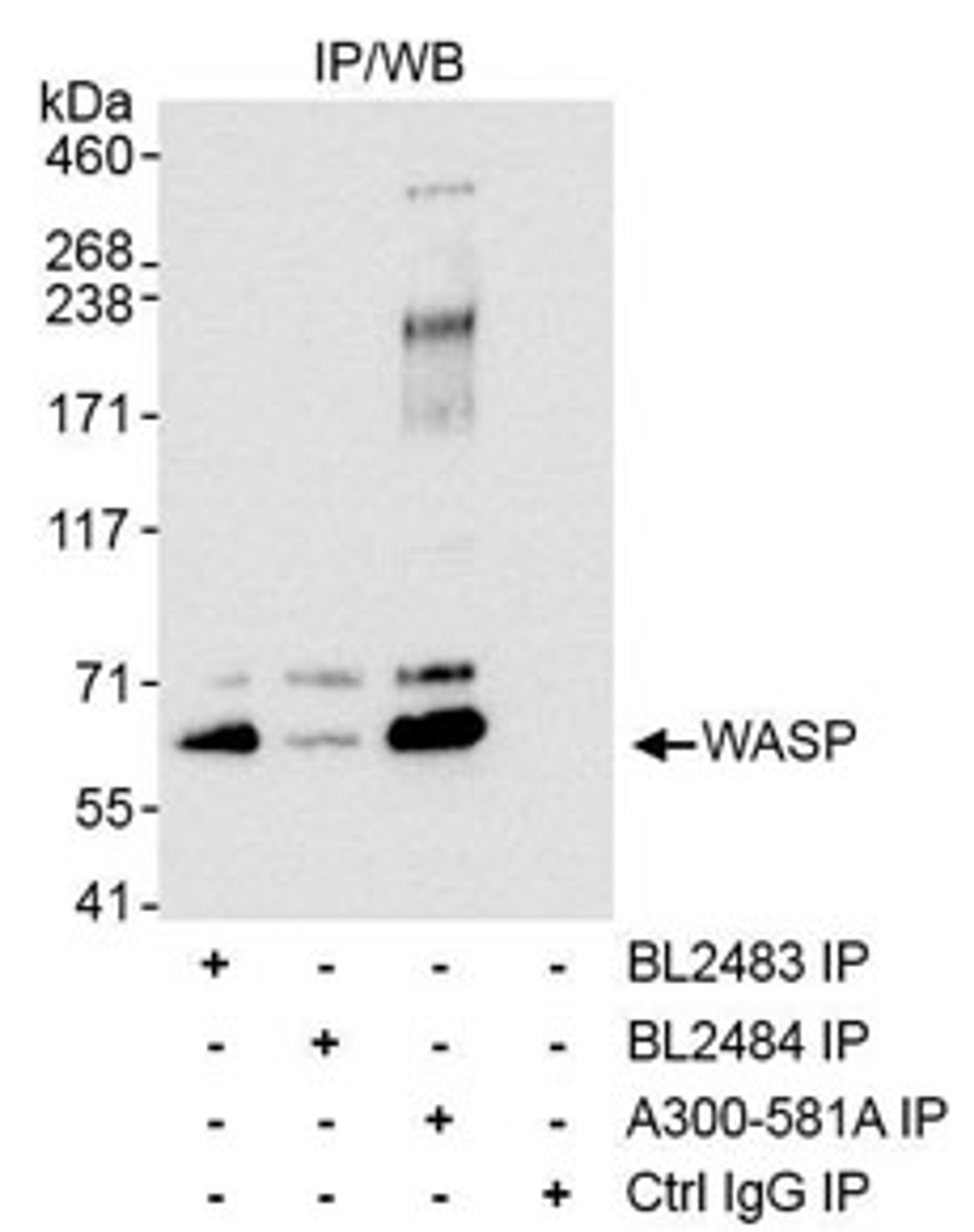 Detection of human WASP by western blot of immunoprecipitates.