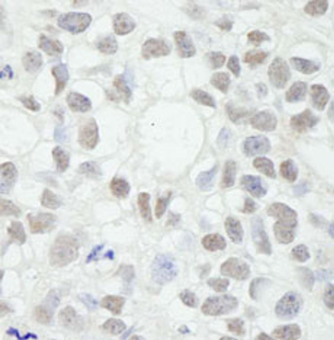 Detection of human MED12 by immunohistochemistry.