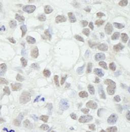 Detection of human MED12 by immunohistochemistry.