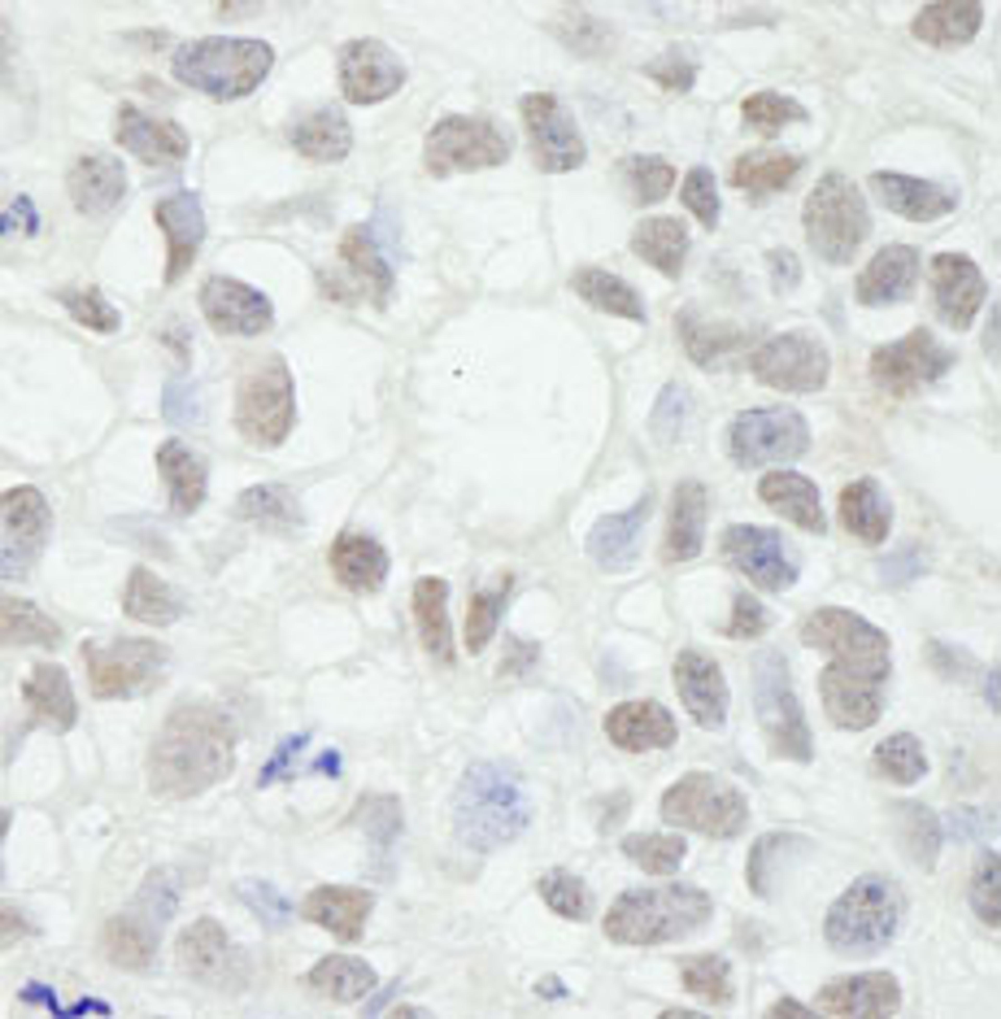 Detection of human MED12 by immunohistochemistry.