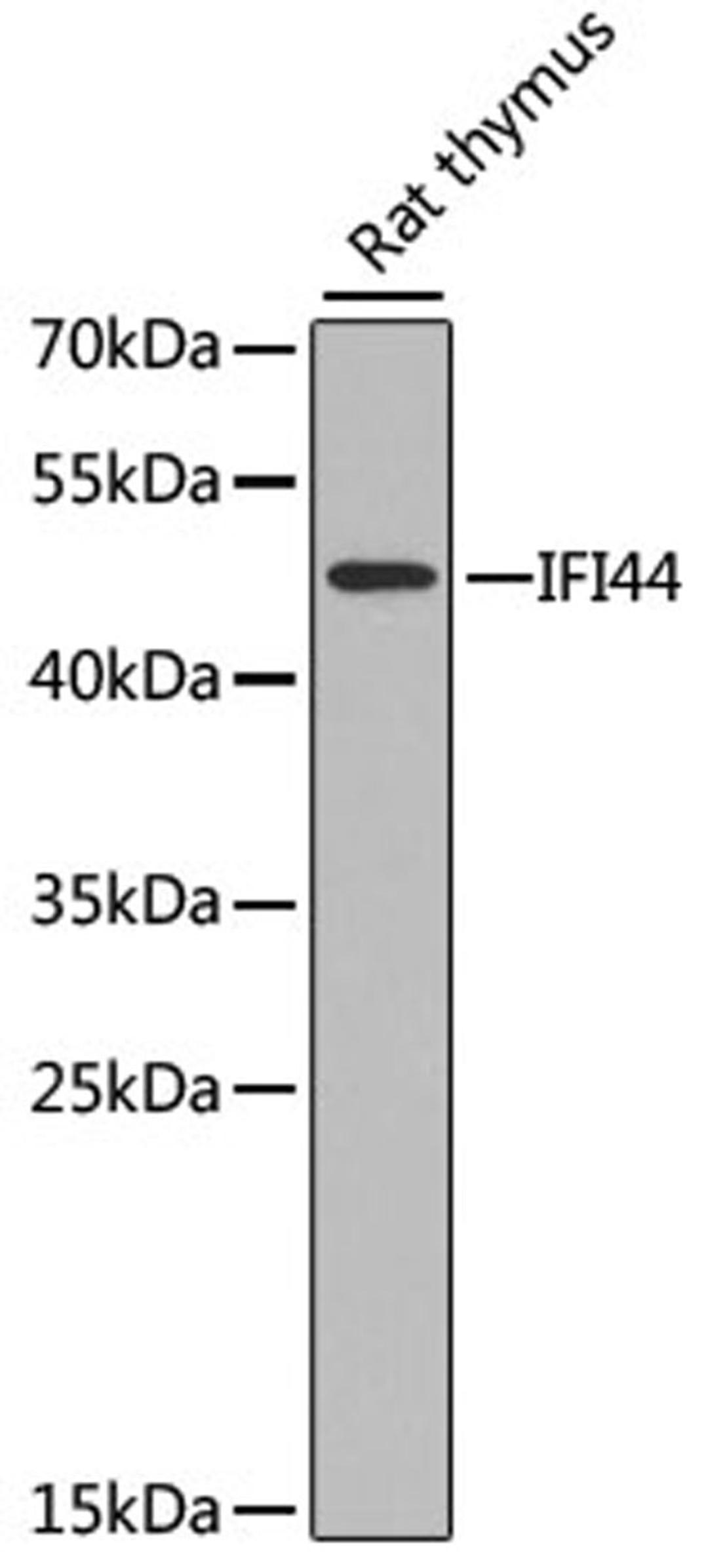 Western blot - IFI44 antibody (A8188)