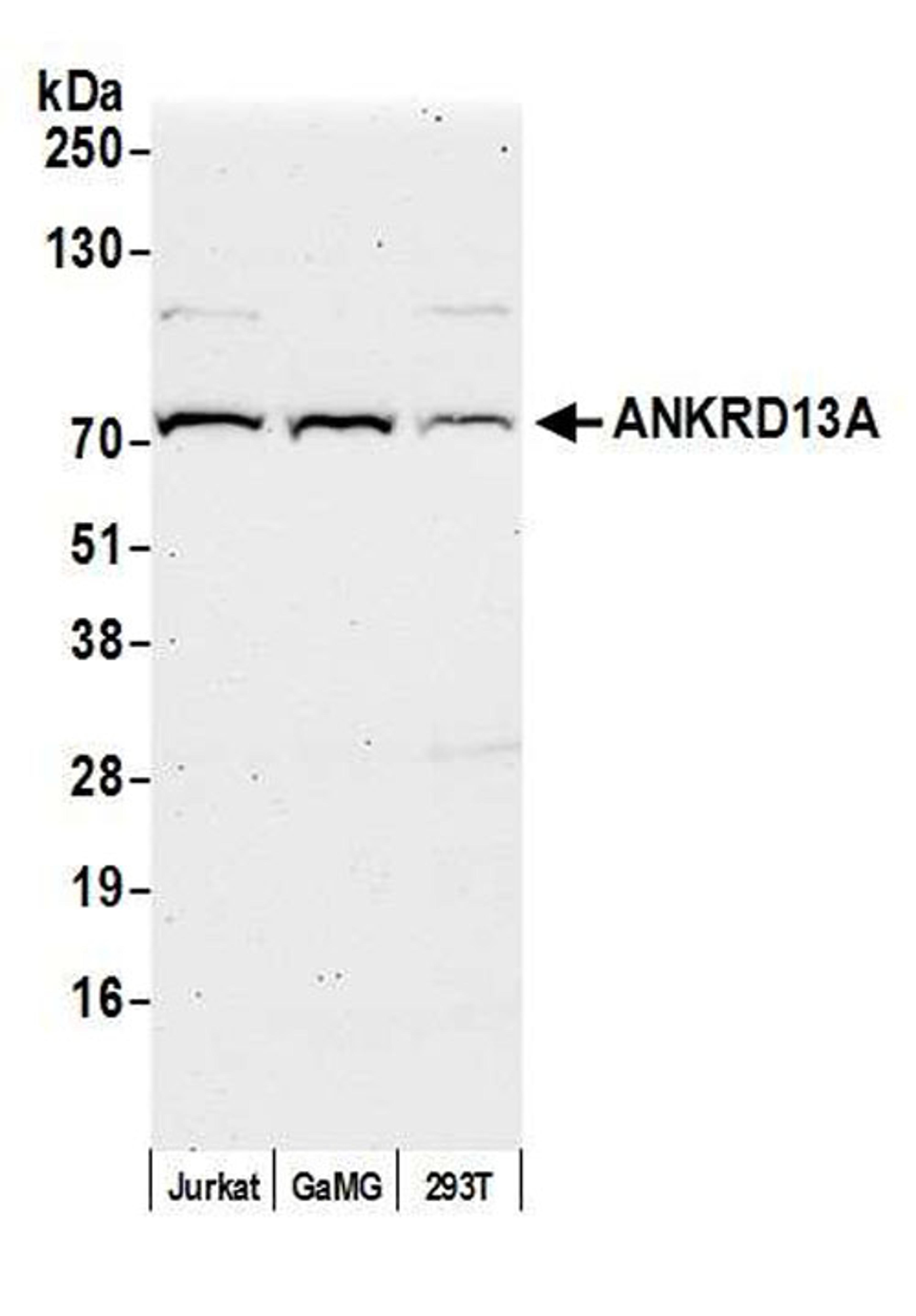 Detection of human ANKRD13A by WB.