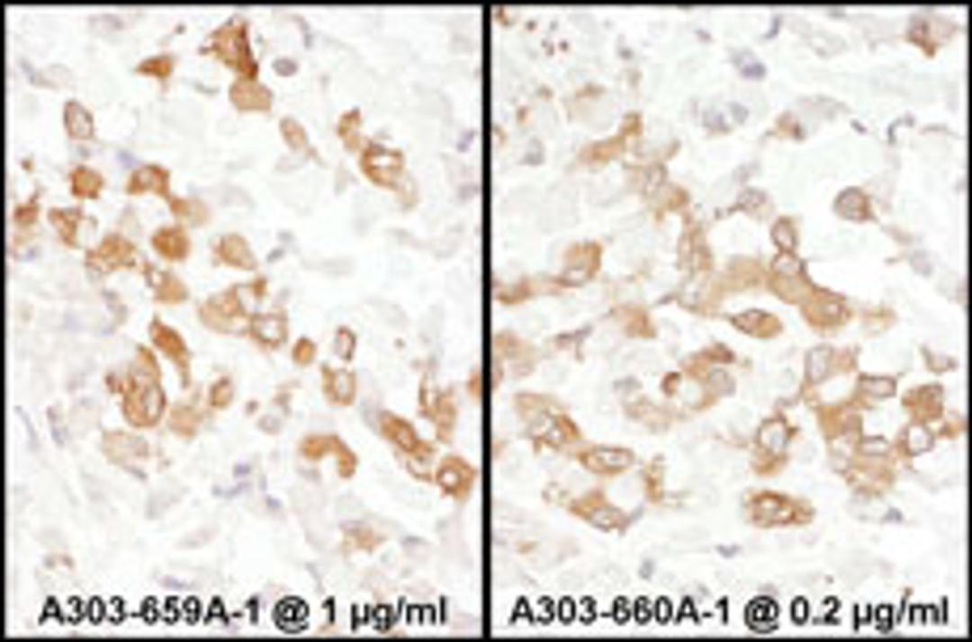 Detection of human PKM2 by immunohistochemistry.