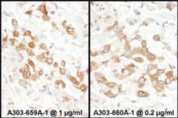 Detection of human PKM2 by immunohistochemistry.