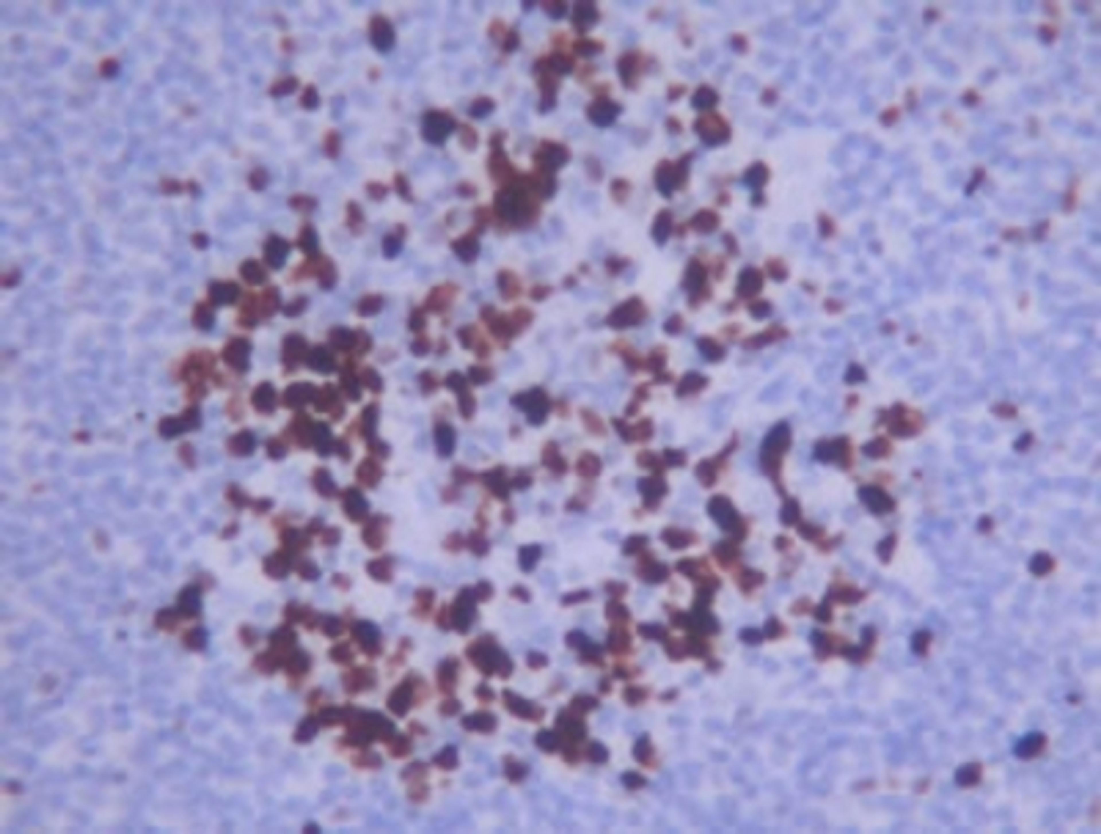 Immunohistochemistry: Ki67 Antibody [NB110-90592] - Detection of human lymph node using NB110-90592. (20X)