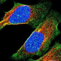 Immunocytochemistry/Immunofluorescence: MLF1 Interacting Protein Antibody [NBP1-85689] Staining of human cell line U-2 OS shows positivity in nucleus, cytoplasm & centrosome.