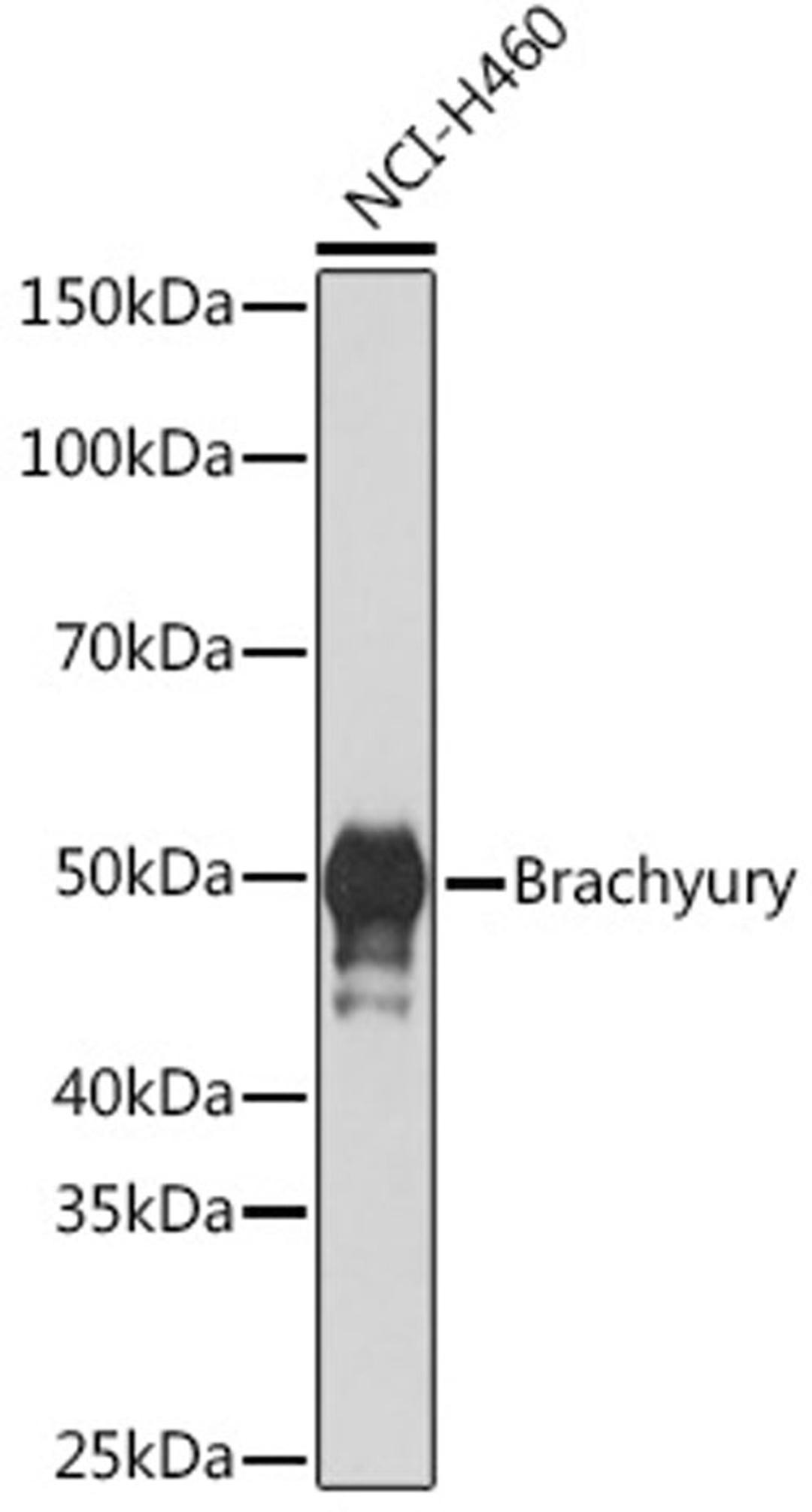 Western blot - Brachyury Rabbit mAb (A5078)