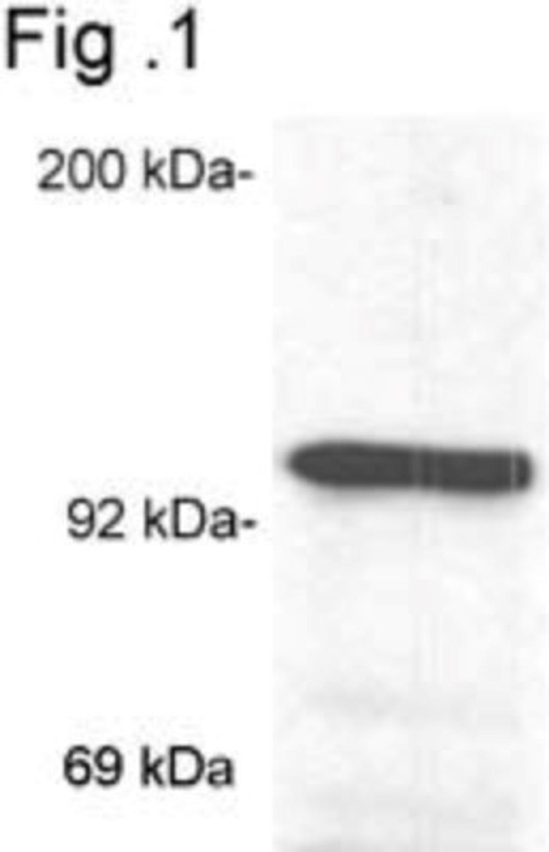 Western Blot: GR/NR3C1 Antibody (BuGR2) [NB300-731] - Analysis of glucocorticoid receptor on mouse liver extract.