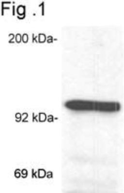 Western Blot: GR/NR3C1 Antibody (BuGR2) [NB300-731] - Analysis of glucocorticoid receptor on mouse liver extract.